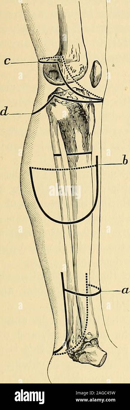 Membrana interossea Fotos und Bildmaterial in hoher Auflösung Alamy