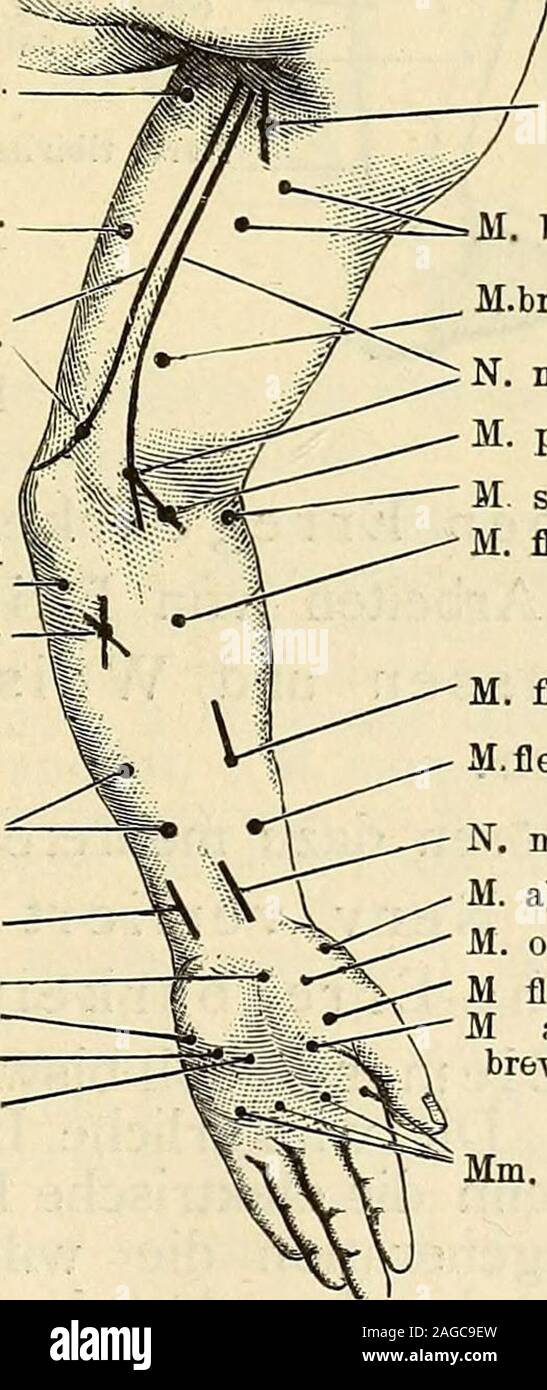 . Elektrizität Sterben in der Medizin und Biologie: eine zusammenfassende Darstellung für Mediziner, Naturforscher und Techniker. M. deltoidesbintereHälfte. - YM. deltamuskel., vord. Lehrwerk. N. Haltungs- und cutaneus. M. biceps brachii M. Positionen internus. N. medianns. M. Pronator teres. M. supinator longus M. flexor Carpi rad. M. flexor Ziffer. UNTERL. M. flexor pollicis Lang. N. medianus. M. abduc. Umfrage. BREV. M. opponens Poe. M flexor. Umfrage. BREV. M Adduktoren pollic. BREV. Mm. Lumbricales. Abb. 82a und b. Innervierten Muskeln langsam absterben - "Entartung durch Läh- mung, paralytische Makuladegeneration - das ist überall Stockfoto