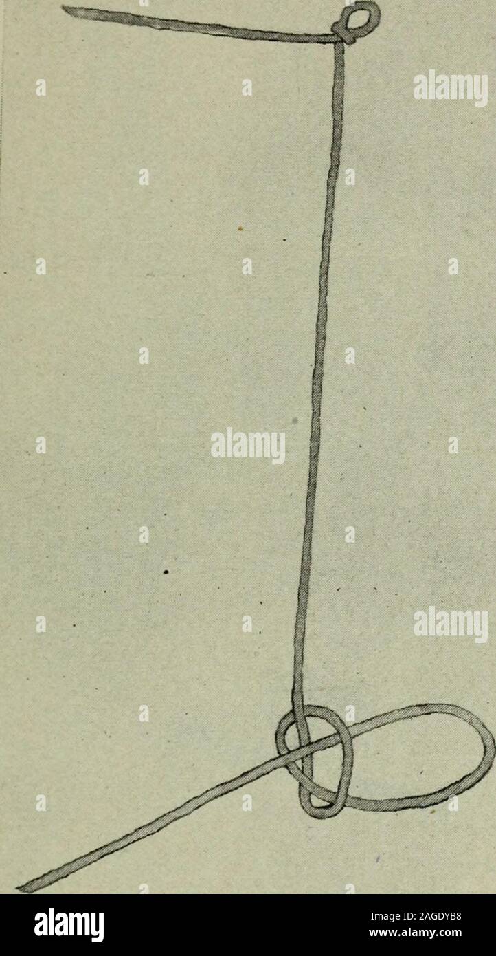 . Plexus. Abb. 2 - Naht von der Linea alba, in Position V" gebunden. Abb. 3-Diagramm des Knoten. Uns Stockfoto