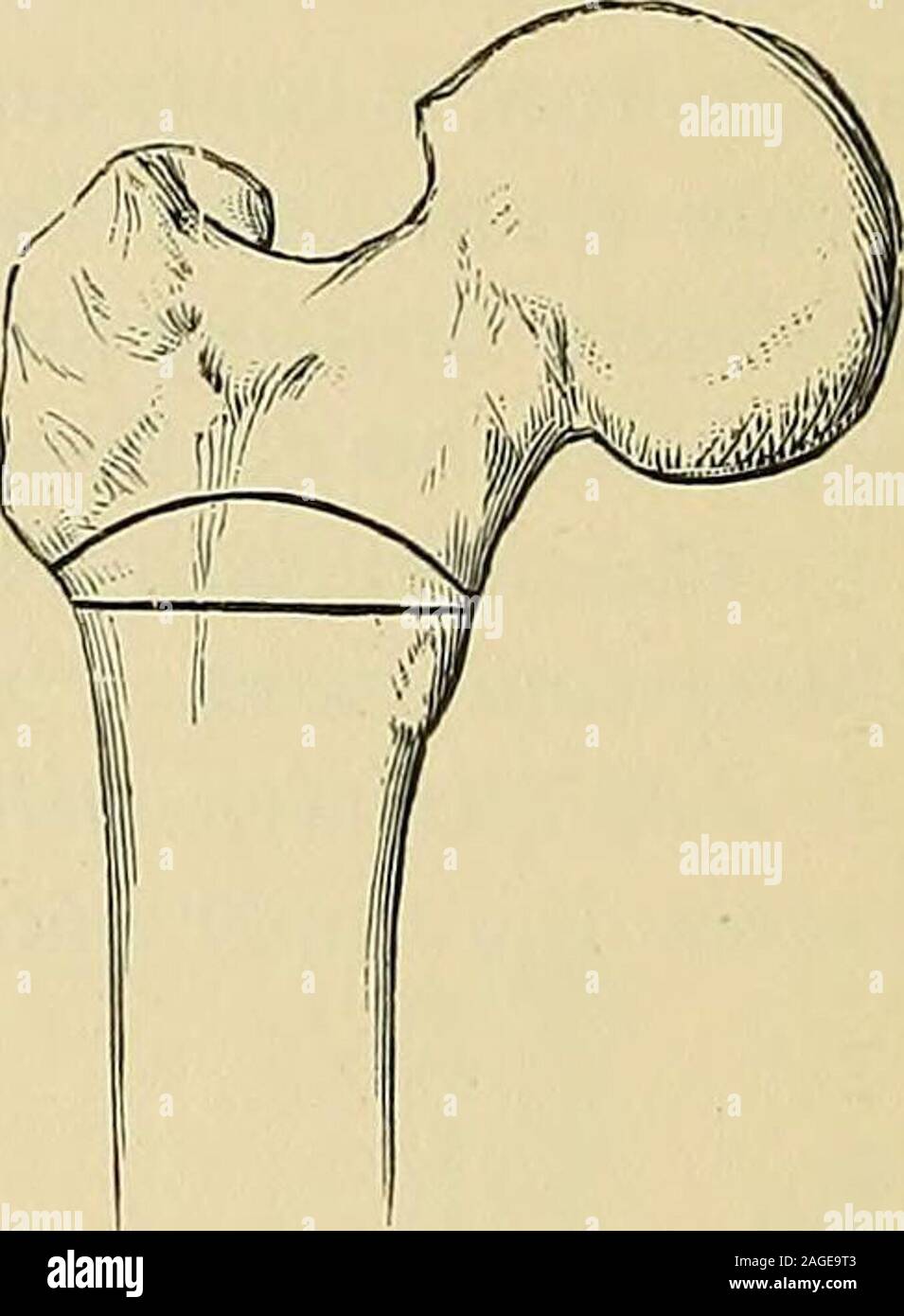. Operative Chirurgie. 438 operative SURaERY.. Schwein. 457. Sayres