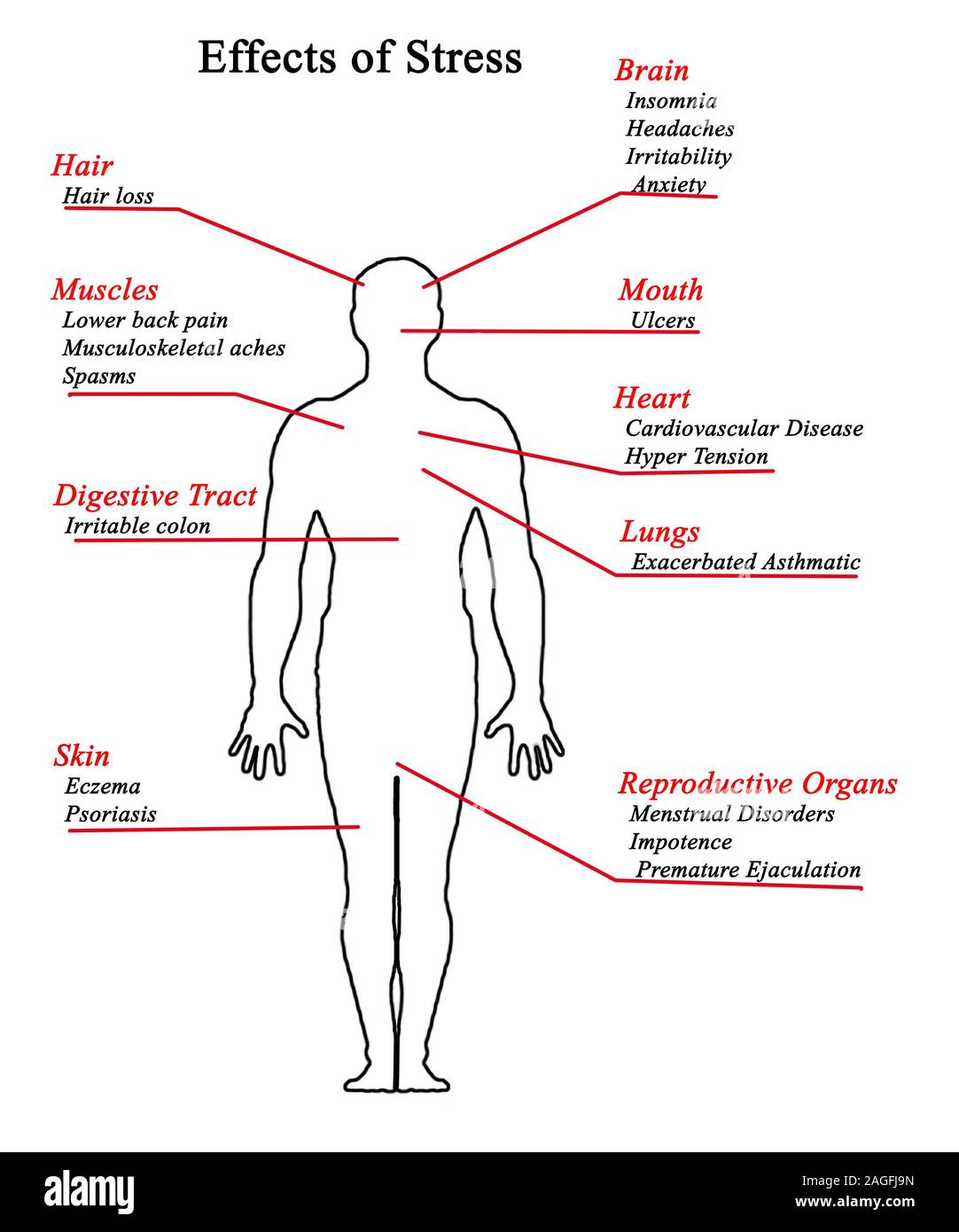 Auswirkungen von Stress Stockfoto
