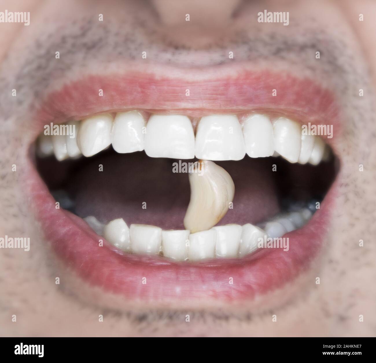 Zwischen den Zähnen eine männliche, eine nelke von rohem Knoblauch ... und Mundgeruch Stockfoto