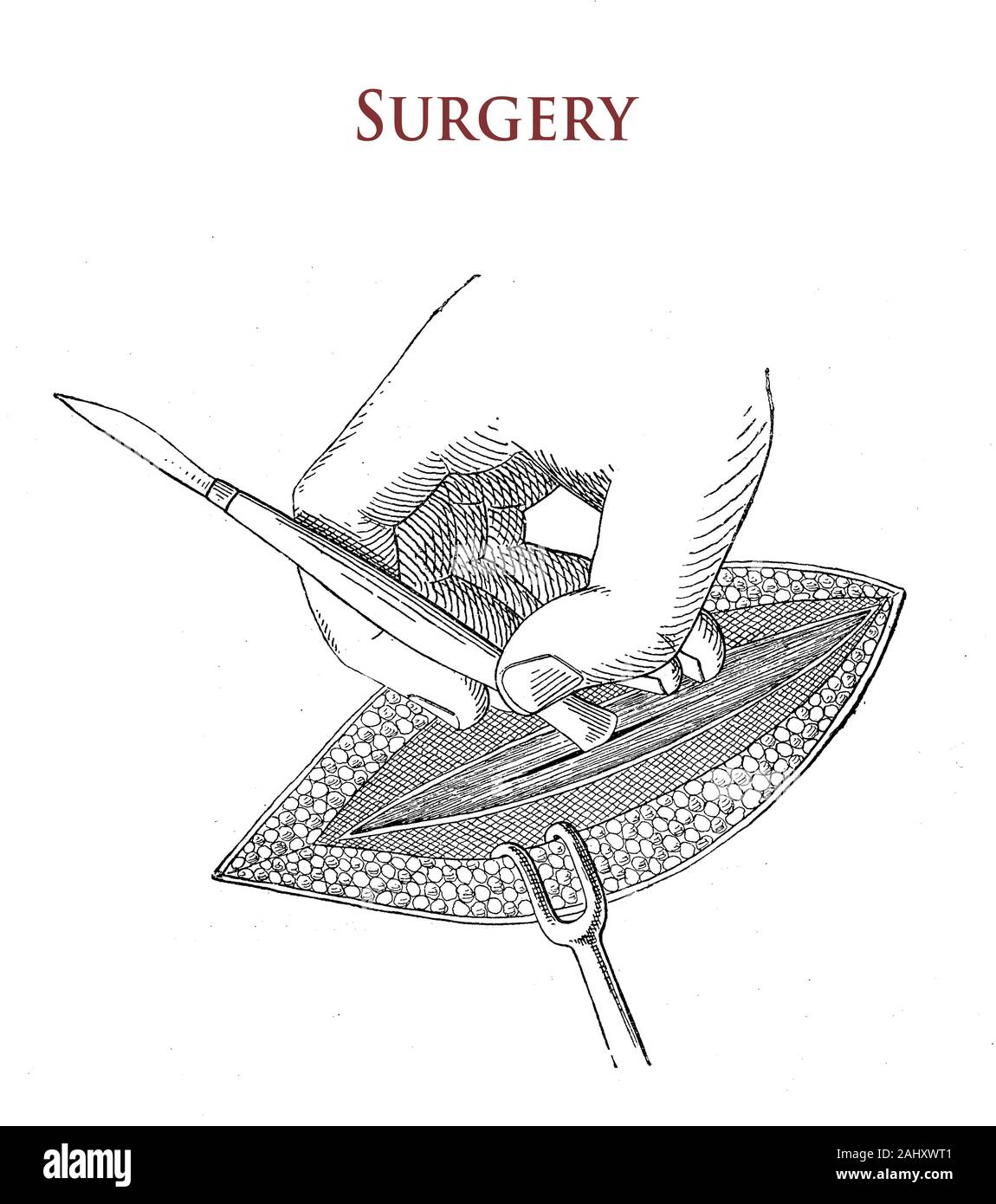Gesundheitswesen und Medizin: Chirurgie, das Eingreifen des Bedieners Stockfoto
