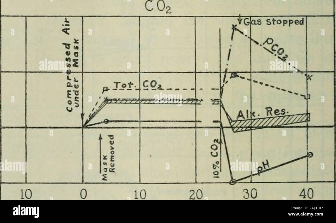 Die Zeitschrift für Biologische Chemie. Experiment 12 Anoxemia + 4 +20 +10 -10 +0,2 +0,1 0,0 • 0,1 Experiment. Abb. 4. die Wirksamkeit der Belüftung unter ihm, ein leichter Anstieg der alkalireserve mit kräftigen Lüftung durch Streaming airthrough die Maske beobachtet werden, und ein leichter Rückgang bei Dead Space erhöhte, verminderte Sauerstoffspannung oder erhöhte CO2-Spannung induziert. Die Experimente mit oxjgen sind jedoch nicht völlig Con-sistent mit der Interpretation. Die zweite Interpretation beruht auf der Tatsache, dass, wenn die Schwankungen der alkali Cullen, Austin, Kornblum, und Robinson6 Stockfoto