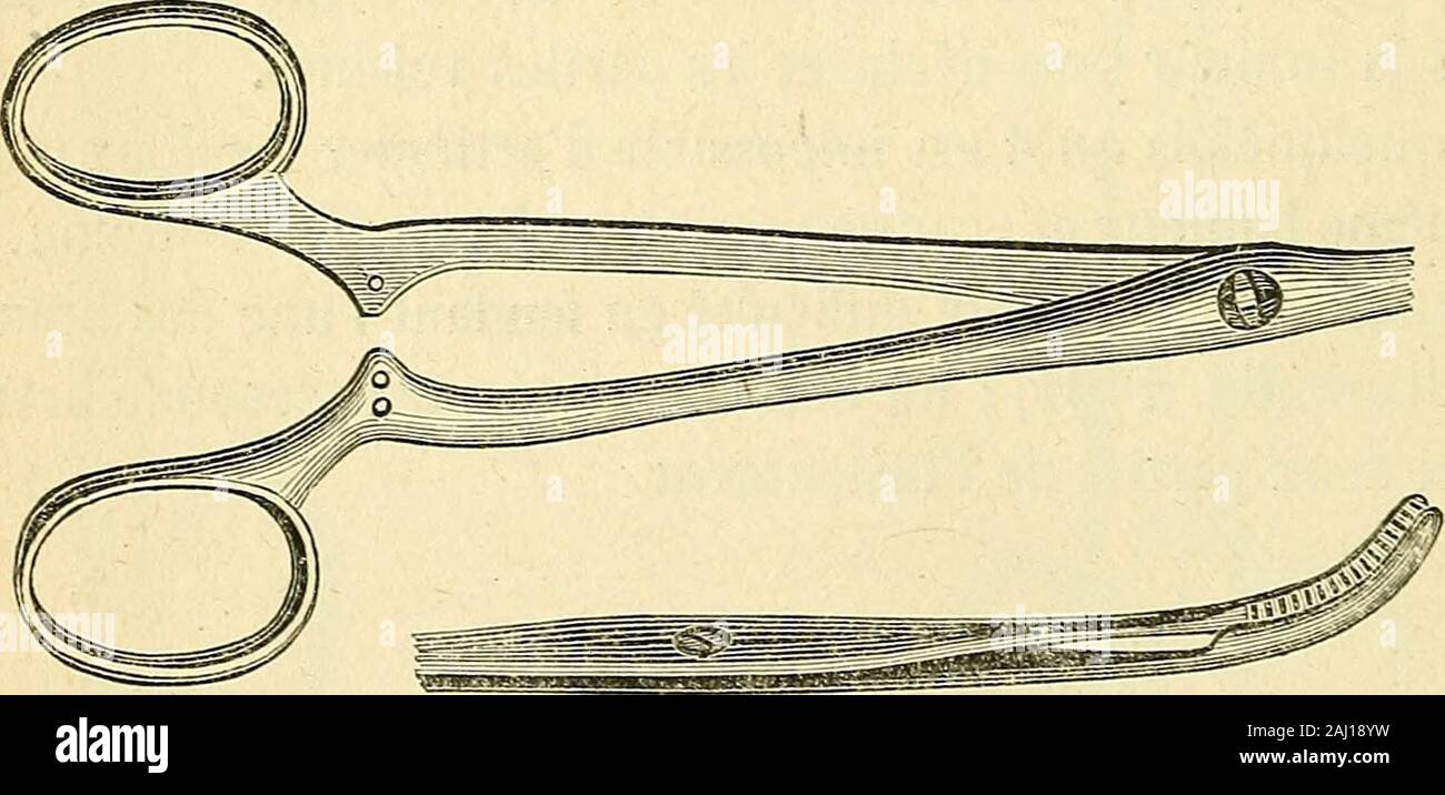 Arsenal de la Chirurgie contemporaine: Beschreibung, Mode d'Emploi et appréciation des appareils et Instrumente en Nutzung pour le Diagnostic et le traitement des maladies chirurgicales, l'orthopédie, La prothése, Les opérations simples, générales, Spéciales et obstétricales. Abb. 1702. - Pince de MClintock. Eine Liïer construit une Pince dont les Mors sind représentés par Deux - neaux Munis dune profonde rainure sur leurs Gesichter juxtaposées. Lesrebords des Deux gouttières, simprimant dans la tumeur, lesmors empêchent de glisser; ces Mors, Étant parfaitement Mousses, ne déterminent au-cun écoulem Stockfoto