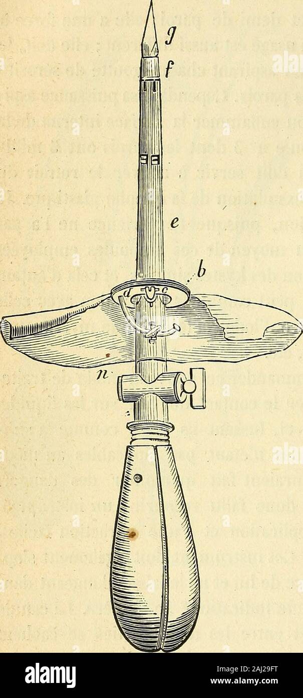 Arsenal de la Chirurgie contemporaine: Beschreibung, Mode d'Emploi et appréciation des appareils et Instrumente en Nutzung pour le Diagnostic et le traitement des maladies chirurgicales, l'orthopédie, La prothése, Les opérations simples, générales, Spéciales et obstétricales.ans le Kyste, se faire un bourrelet dilatentet viennent de 3 de diamètre centimètres lekyste attiré par lequel est maintenu et contre les téguments. Dautre part, un-Mann-chon à-vis fait avancer jusque Contre la peau un disque métallique bascu-lant, des Deux Plaketten formé contre une Rondelle debaudruche lesquelles sinsère. Stockfoto