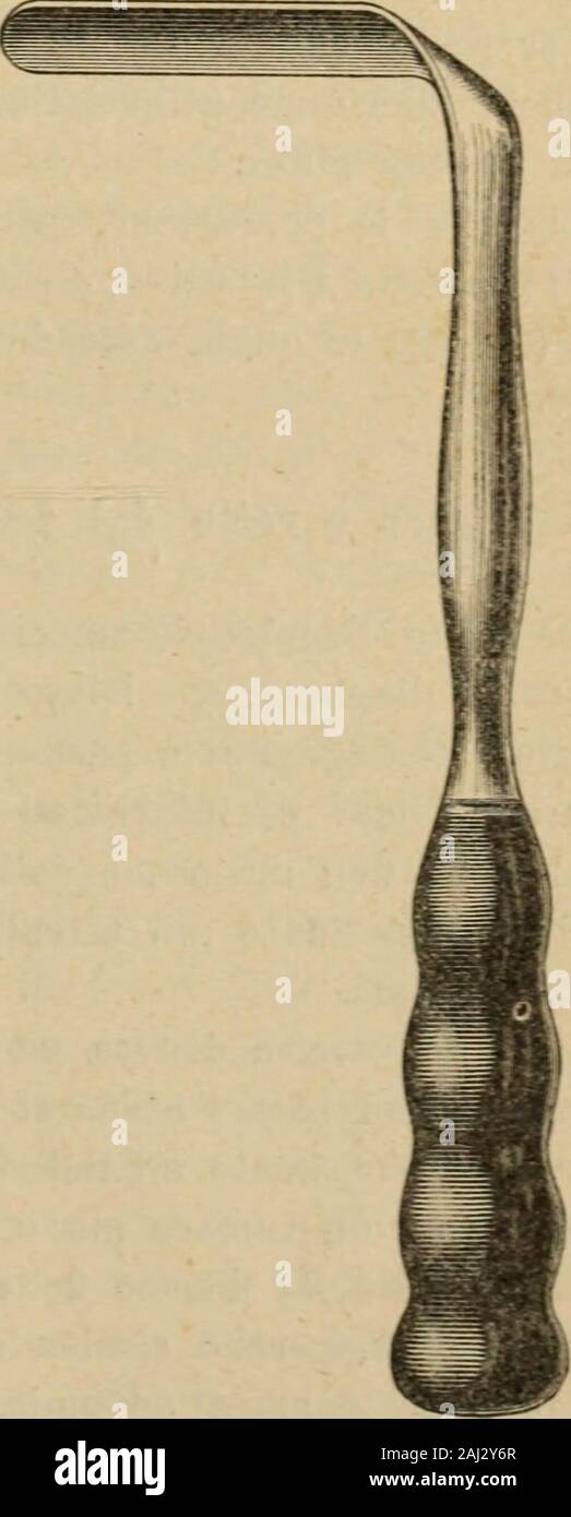 Patologia e terapia delle malattie delle Donne ad uso dei Medici pratici. Abb. S. - Valva posteriore in Metallo. - Valva laterale in Metallo. chiarezza Solo il Collo, o quella Parte di Parete vaginale che fa Spor - genza nel Loro lume, e daltra Parte può riescir utile lesame della Pa-Rete vagiaale su Grande estensione o lispezione Di quella Parte di Pa-Rete vaginale che si inserisce al Collo, io ricorro pro Simili scopi aglispeculum univalvi, e specialmente eine muniti quelli di manico, comequello di Kristeller (Abb. 7). Tengo a Mia disposizione una valva piùgrande Ed una Piccola, più di Metallo Stockfoto