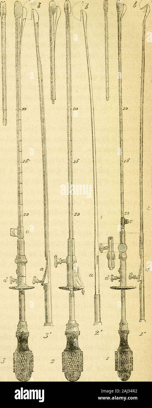 Arsenal de la Chirurgie contemporaine: Beschreibung, Mode d'Emploi et appréciation des appareils et Instrumente en Nutzung pour le Diagnostic et le traitement des maladies chirurgicales, l'orthopédie, La prothése, Les opérations simples, générales, Spéciales et obstétricales. Mir b, fixée au Porte-lame par une char-nière. Cet Instrument est munidun curseur C. A côté se trouveune Teil de la tige laquelleest fixée à la Vis de pression. -. Le même Instrument, plusgros; La lame fait Corps avec latige Porte-lame, et le mécanismede La Crémaillère est en dehors. Sur 13 tige du Porte-lame 2 estune ent Stockfoto