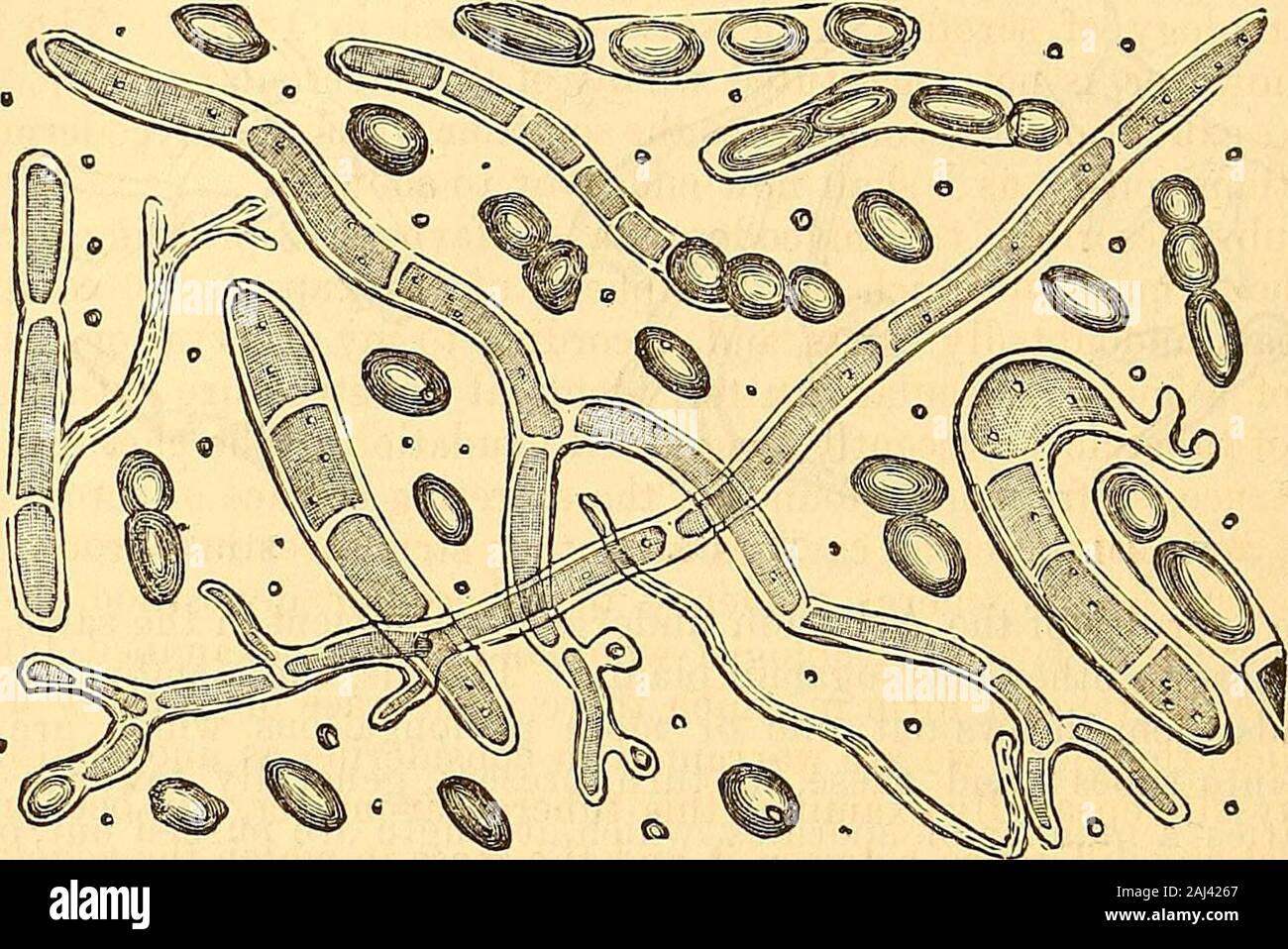 Klinischen Vorlesungen über die Grundsätze und die Praxis der Medizin. ulartissue der Haut (Bateman. Gallot, Thomson). Nach Gruby theplants wachsen in den Zellen der Epidermis, die wahre Haut wird komprimiert, Abb. 494. Sporules entwickeln auf der Oberfläche eines Apple, nach drei Tagen. Abb. 495. Die gleiche nach vier Tagen. Abb. 496. Die gleiche mehr voll auf den menschlichen Arm entwickelt, nach der Inokulation, a, Thalli, mit hellen Wänden, b, in die sporules (myzelien); c, Myzel getrennt vonden Thallus: d, sporules aus dem Myzelium abgeteilt (nach remak). 300 Durchm. 860 KRANKHEITEN OE DIE INTEGUMENTARY SYS Stockfoto