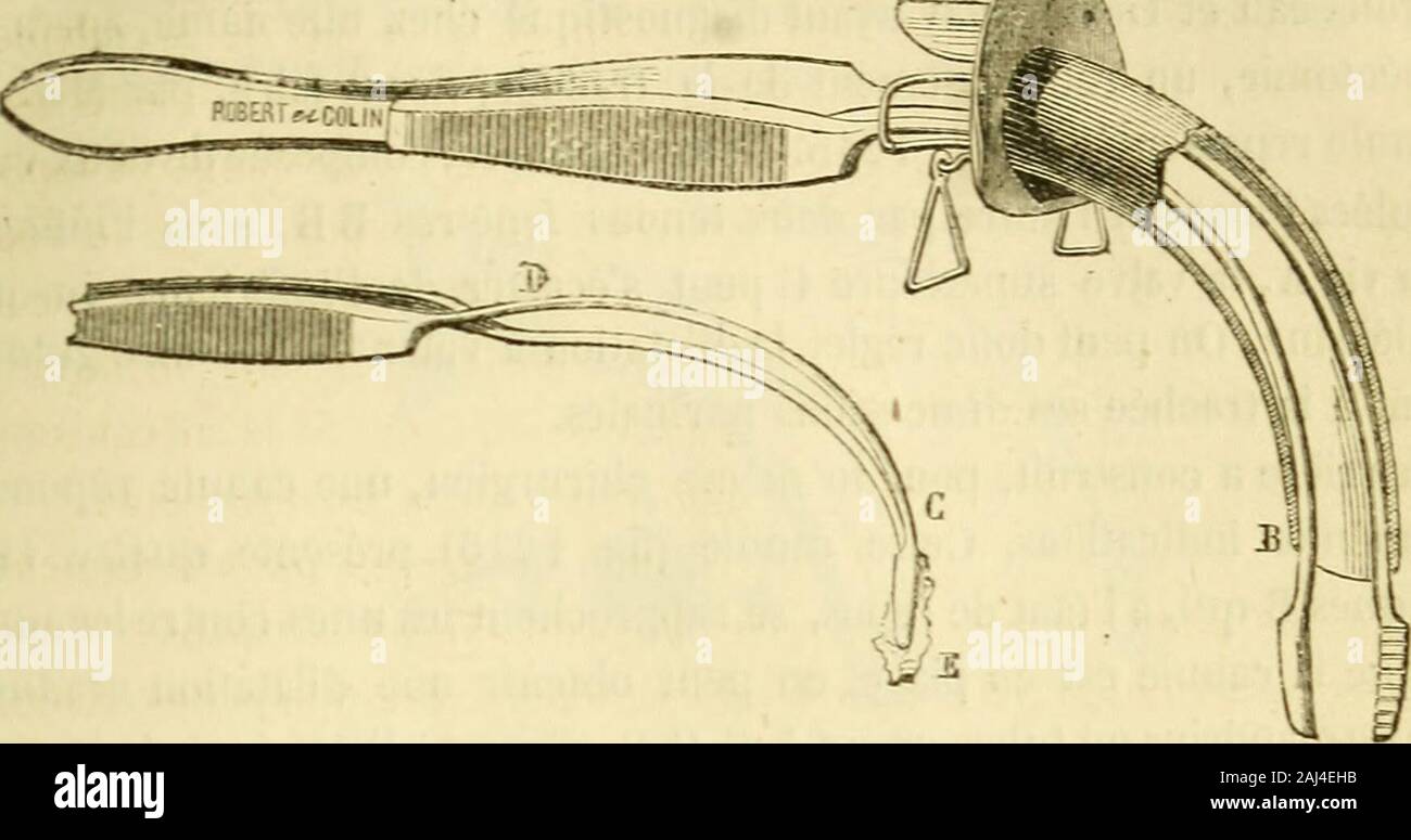 Arsenal de la Chirurgie contemporaine: Beschreibung, Mode d'Emploi et appréciation des appareils et Instrumente en Nutzung pour le Diagnostic et le traitement des maladies chirurgicales, l'orthopédie, La prothése, Les opérations simples, générales, Spéciales et obstétricales. Abb. 1212. - Écouvillnn de Trousseau, tard Il renonça à cette pratique. Cependant auf est ins obligé de fairelextraction de fausses Membranen se présentant dans la canule. Eine imaginé une Pince à longues Zweige entre Valéry-Meunier - Croisées TRACHEOTOMIE [CANULES). 573 Bg. IJ 13) qui peuvent se glisser et souvrir Dans 1. Stockfoto