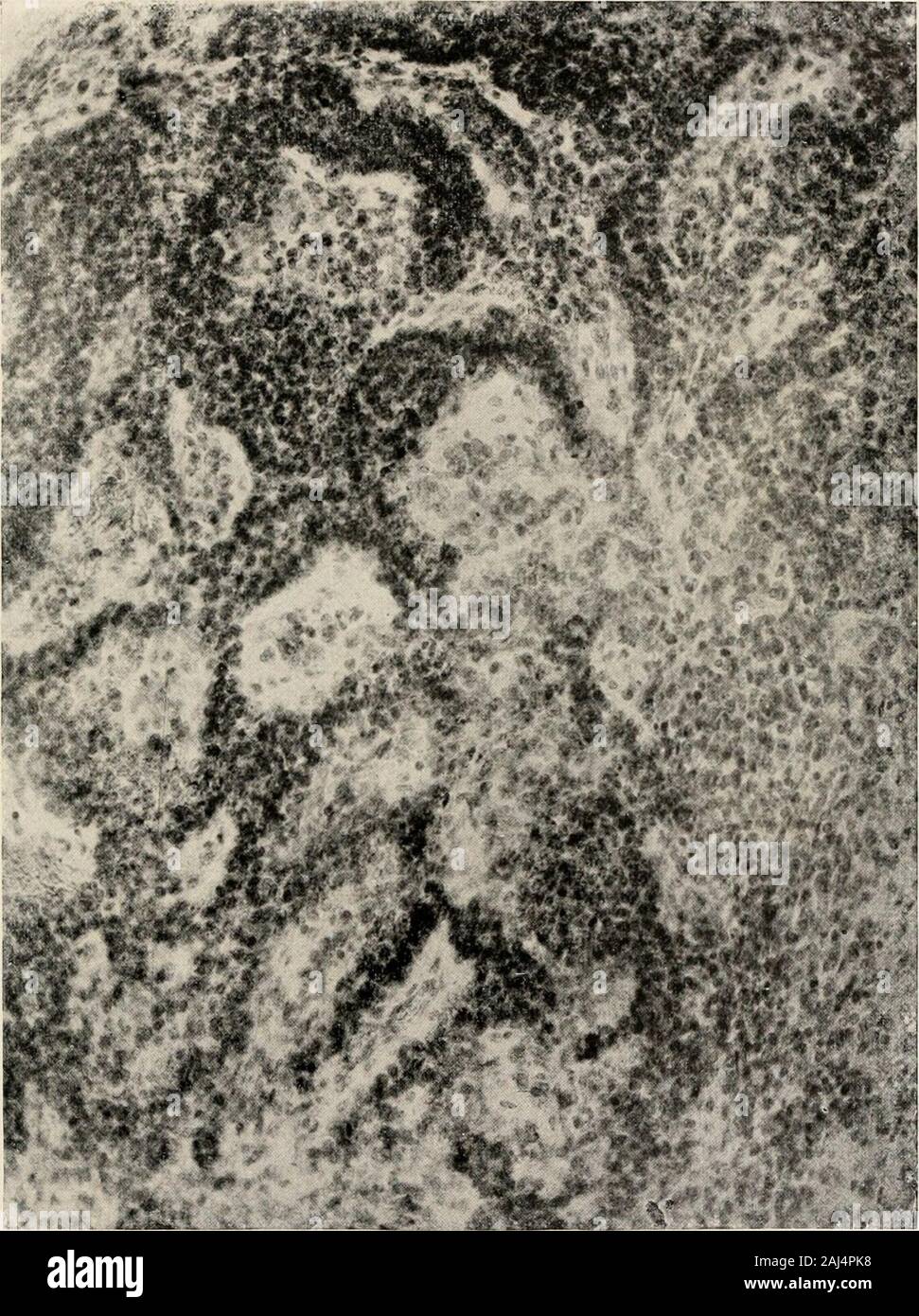 Die Morphologie und die evolutionäre Bedeutung der Zirbeldrüse Körper: Teil I ein Beitrag zur Untersuchung der epiphyse cerebri mit einer Interpretation der morphologischen, physiologischen und klinischen Beweise. Die zirbeldrüse Körper 193. O 0) t+-l&gt; 02 -^a a o a Q cS4&gt;&gt; 83 O 0,5 rv-"^-o o o o m O) r-i r^g Abhandlung Nr. 9 194 FREDERICK TILXEY UND LUTHER F. WARREN Marburg bietet auch eine interessante Beschreibung der Entwicklung der suprapineal Aussparung im Menschen, die dargestellt ist infigure 96. Nach seiner Beschreibung, die suprapineal recessis, geformt durch die dorsale reflecti Stockfoto