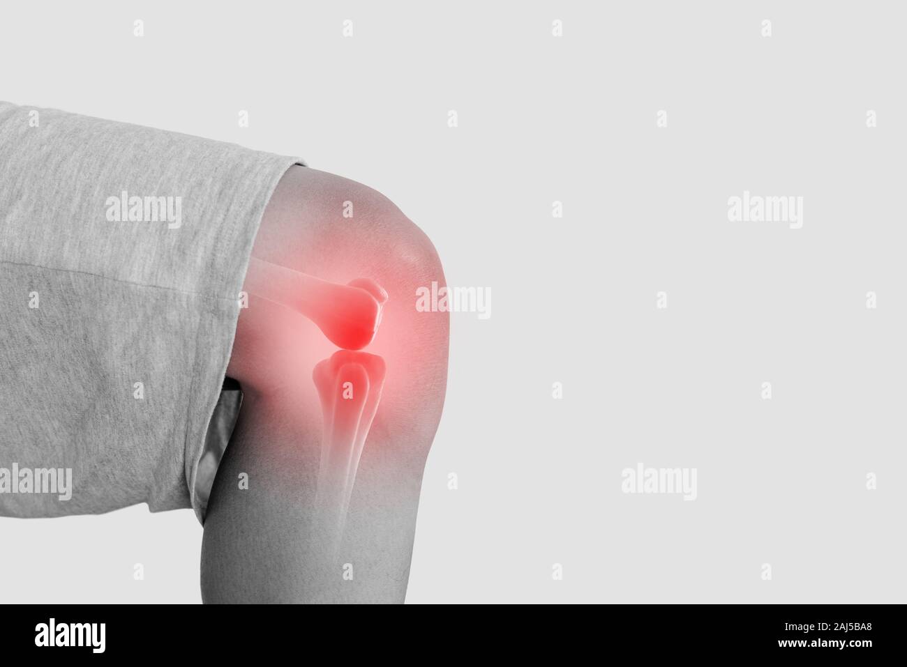 Gelenkschmerzen, Arthritis und Sehne Probleme. Älterer mann Knie auf weißem Hintergrund Stockfoto