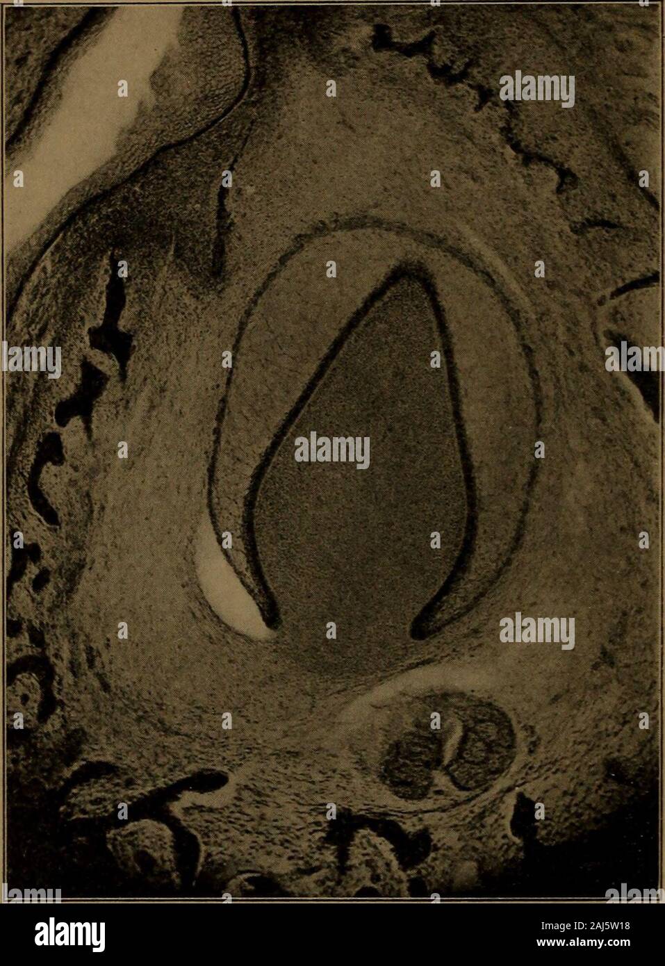 Ein Lehrbuch der zahnärztlichen Histologie und Embryologie, einschließlich Labor Richtungen. Das schmelzorgan, ein wenig älter als Bild. 280. Es zeigt die äußeren Tunika, vorgeschriebenen Waffenrock und das Ganglion Retikulum. Die zahnmedizinische Papille in der hohlen festziehen: Denstopfen. Die Räume sind durch Schrumpfung verursacht. seiner Oberfläche. Der Knochen hat rund um den Zahn herum Meckels cartilageand Edelsteine auf die bukkale und linguale gewachsen, sie in einer offenen Nut, die später com werden abgeschlossen und in separate Krypten für jeden Zahn unterteilt. Abb. umschließt. 285 ist von einem ähnlichen Muster in der Region einer Seeschwalbe - 368 DIE ENTWICKLUNG DES ZAHNES GERM Stockfoto