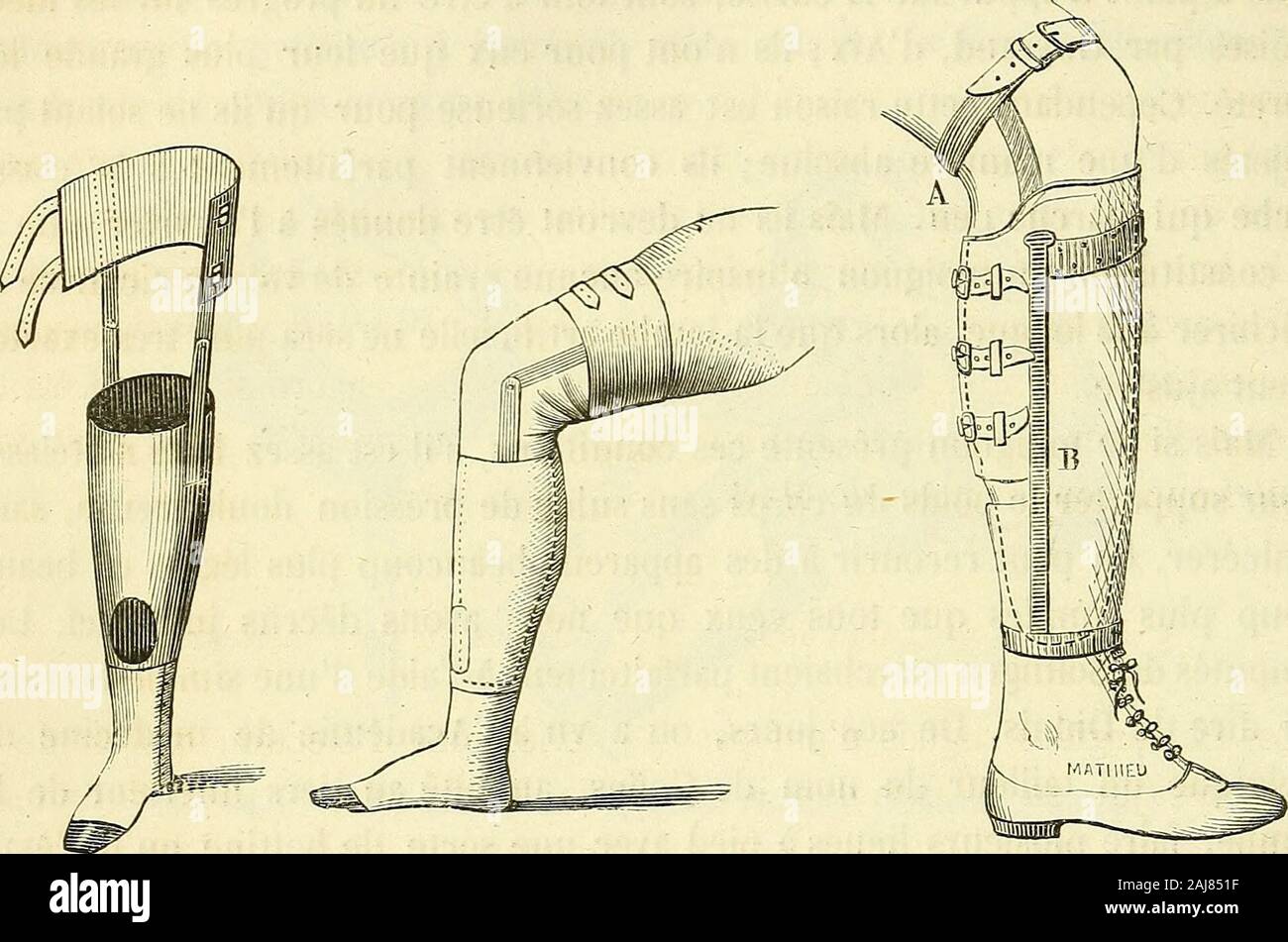 Arsenal de la Chirurgie contemporaine: Beschreibung, Mode d'Emploi et appréciation des appareils et Instrumente en Nutzung pour le Diagnostic et le traitement des maladies chirurgicales, l'orthopédie, La prothése, Les opérations simples, générales, Spéciales et obstétricales. ls se Compo-gesendet (Abb. 584) dune gaine embrassant exactement La jambe, et se angewiesen, par de deux lintermédiaire attelles Dacier, à une Sorte de la cuisse jarretière quientoure; ces attelles et celte jarretière nont dautre aber quedempêcher lappareil de glisser. Le Pied artificiel est mobile sur la jambeau Moyen de deux Res Stockfoto