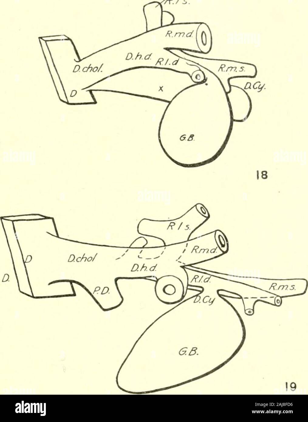 Das amerikanische Journal der Anatomie. Tic-Kanäle. Die frühesten Indi- kation des hepatischen Kanäle wurde in der descriptionof die Bildung der Leber hin. In einem Modell eines Embryo etwa 5 mm lang, wie vorher angegeben, der Hohlraum der earlyhepatic Anlage erstreckt sich weit seitlich. Auf beiden Seiten die cavityis eingeengt dorso-ventral. Von den Zeichnungen in die weitere Untersuchung der Bauchspeicheldrüse festgestellt wurde, dass dieser Kanal attachedby wurde mit einem kleinen Röhrchen an der linken Seite des ventralen Leitung der Bauchspeicheldrüse. Die epitheliale Auskleidung gezeigt glich der Gallenblase - biadder, für die Stockfoto