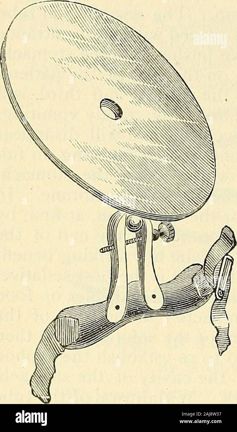 Katalog der Sharp & Smith: Importeure, Hersteller, Großhändler und Einzelhändler in chirurgischen Instrumenten, Mißbildung, Apparate, künstliche Gliedmaßen, künstliche Augen, elastische Strümpfe, Traversen, Krücken, Unterstützer, galvanische und faradischer Batterien, etc., Apparate, Chirurgen jeder Beschreibung. Vergessen. Bei der Verwendung von whathe Begriffe Milch Wismut, Dujardin-Beaumetz rät, daß die Lösung beallowed ein paar Minuten im Magen zu bleiben, damit die Wismut tobe hinterlegt; nach dem Die überstehende Flüssigkeit entnommen werden kann. Lavage sollte durchgeführt werden, wenn der Magen leer ist; daher Stockfoto