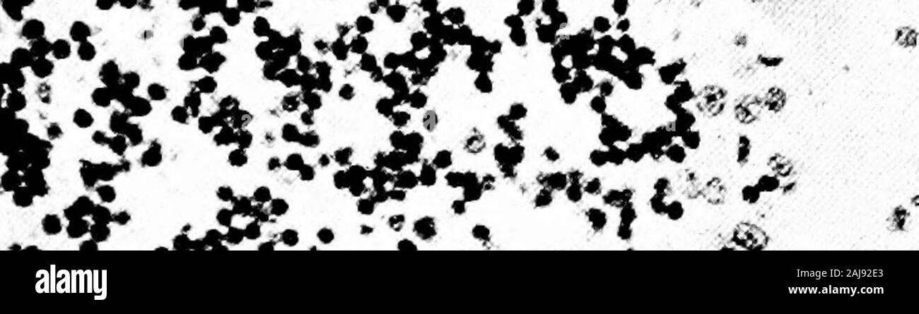 Eine mechanistische Auffassung von Krieg und Frieden. M?. 5"&lt;?^^M^V? Abschnitt des kleinhirn eines Soldaten, die Hunger, Durst gelitten hatte, und der Verlust von Schlaf; hatte die außerordentliche Gewaltmarsch von i 8o km von Mons, der Marne; inmitten der größten Schlacht in seinem -. Ory wurde durch die Explosion von ashell verwundet; für Stunden warten auf Hilfe, und di^ni aus Erschöpfung bald nach reachingthe Krankenwagen. Vergleichen Sie die blass-out erschöpft Purkinje Zellen, erklärte byarrows, mit den Purkinje Zellen in einem, auch durch Pfeile gekennzeichnet. Stockfoto