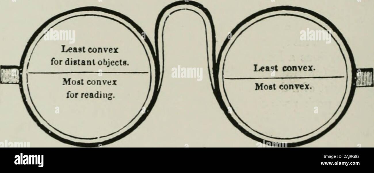 Annalen der medizinischen Geschichte. In einem Brief an George Wheatly, datedPassy, 23. Mai 1785, Benjamin Franklindescribes und zeigt ein paar bifocalglasses, hatte er für seine useby Doliond, der berühmten Optiker von London. Nur, warum diese nützliche Erfindung von Franklinswas zu verfallen in Vergessenheit formany Generationen erlaubt nach ihrer Entdeckung, ist nicht bekannt. Man würde denken, dass eine prac- Optiker wie Doliond havegrasped seinen Wert würde, und dass seine Nützlichkeit., durch die ein Mensch sieht klarsten und besten Anden Abstand zu lesen, ist nicht der bestfor größere Entfernungen. Ich deshalb h Stockfoto