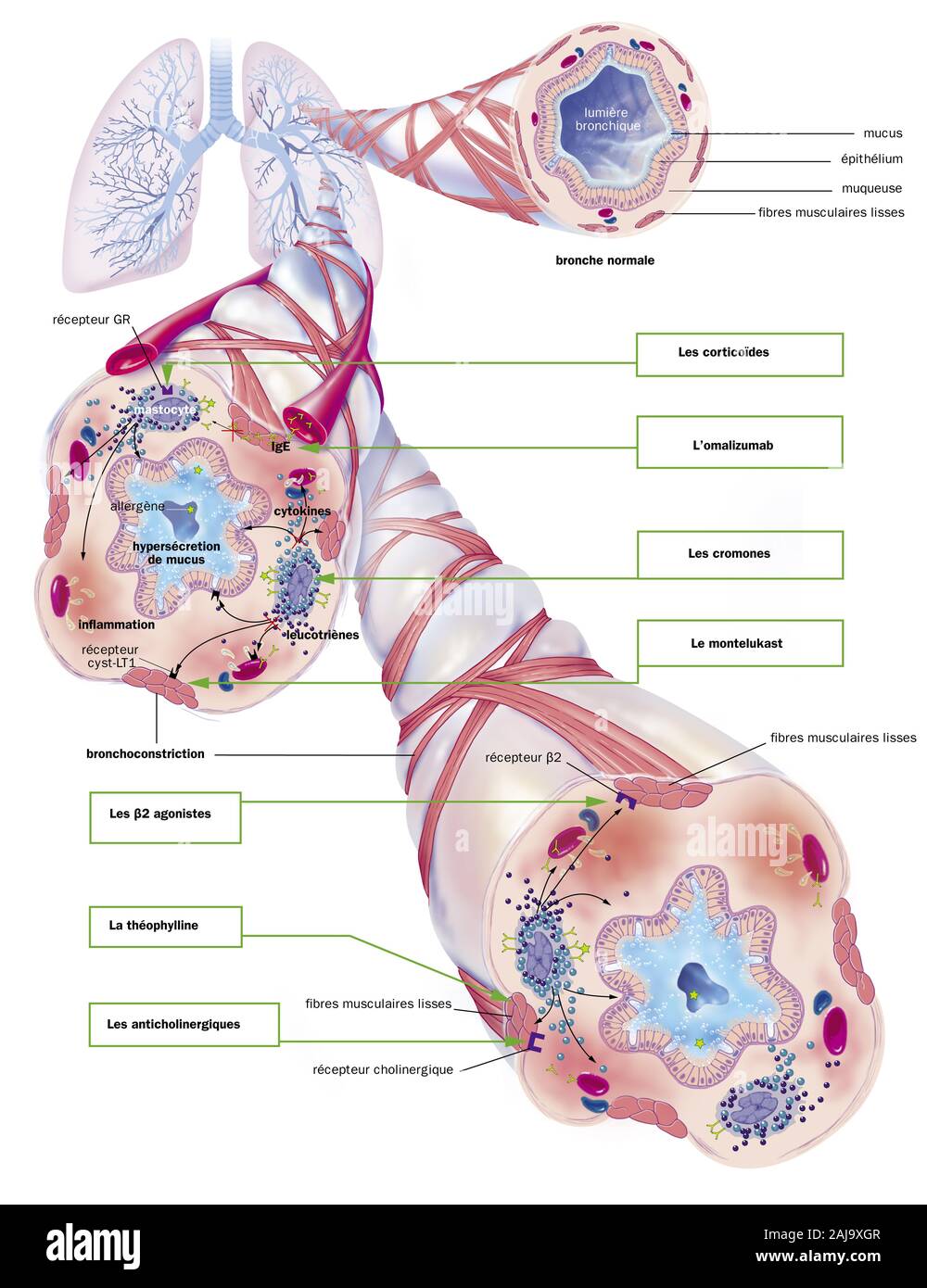 Asthma Stockfoto