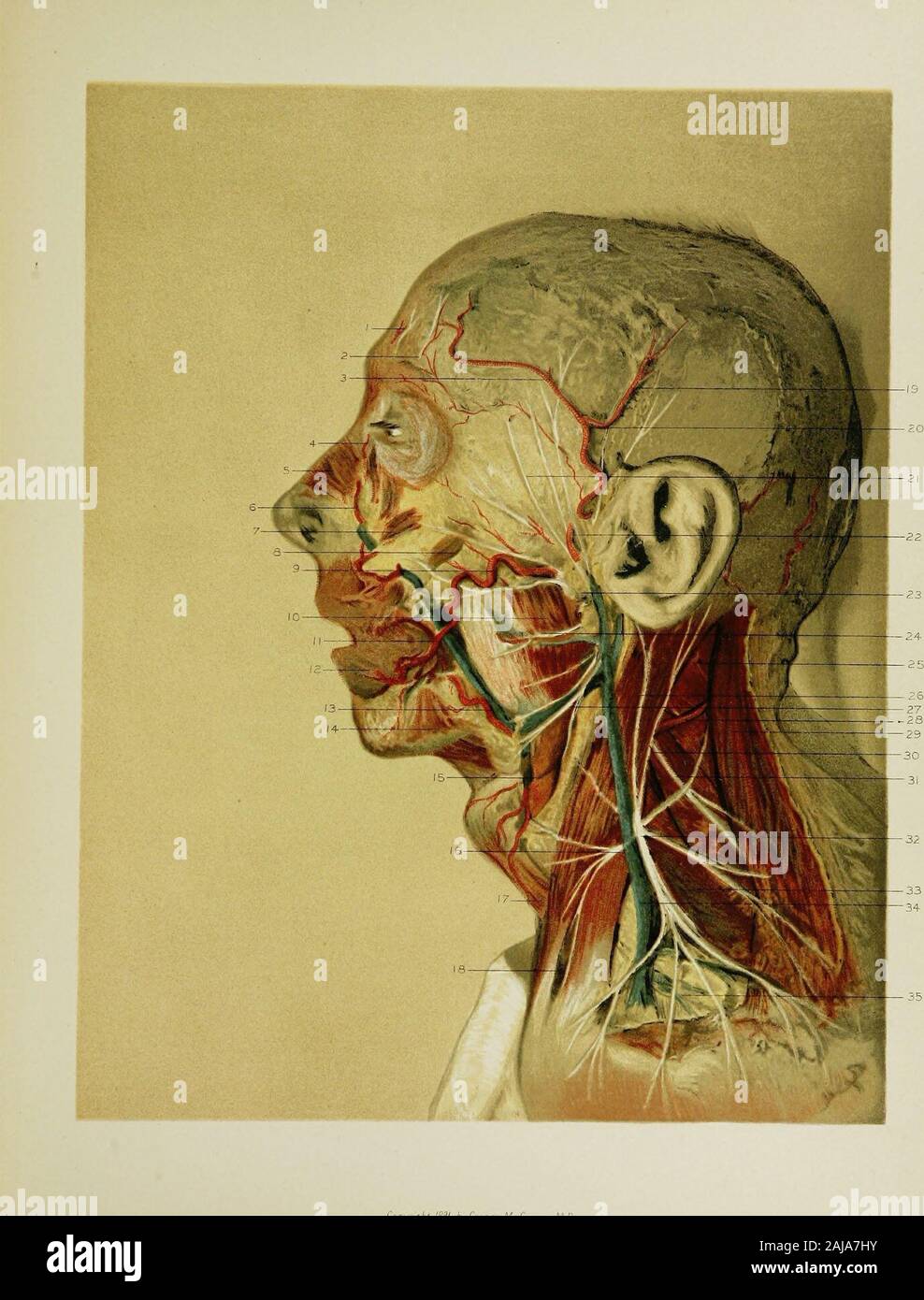 Regionale Anatomie in ihrem Bezug zur Medizin und Chirurgie. eneath der externen Vena jugularis. 17. Die Sterno-hyoid Muskel. 18. Der Zwischenraum zwischen den Sternalen und schlüsselbeinanteil por- Sterno-mastoid Muskel. Der posterioren Zweig der zeitlichen Arterie. Die auriculo-zeitliche Nerv. Die zeitliche Zweige der Gesichtsnerven. Die zeitliche Arterie. Die Überreste der Ohrspeicheldrüse, sie seziert die Beziehungen des Gesichtsnervs zu zeigen, und die spe Anse^ inus. Die Gefäße und Nerven mit dem buccinator splenius capitis Muscle. Der Muskel. Die auricularis Magnus Nerv. Der zervikalen Zweig der Stockfoto