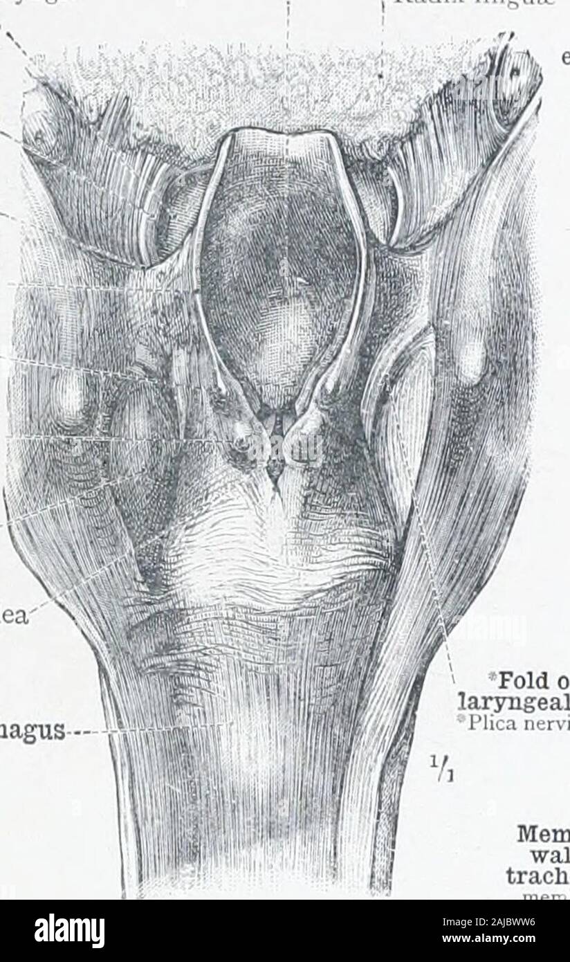 Ein Atlas der menschlichen Anatomie für Studenten und Ärzte. Ventrikel) ist ungewöhnlich groß. Abb. 777 - Die Muskeln und Schleimhäute GlandsOF den Kehlkopf, wie man sieht in der linken Hälfte des Sagittally - hemisectedLarynx. Ein Teil der Schleimhaut, die die Trueand falsche Stimmbänder hat in situ belassen wurde. Siehe Anlage, Hinweis ^^  - siehe Anhang, Note= 9. 3 Arytenovocalis Muskel. - Diese ist durch Ludwis portio genannt aryvocalis musculi. thyreo-, rormc CWri. l. eri,,) Vorrang des corniculuni Laryngis, oder Knorpel von Santorin - lubejculum Birnenförmig sinus Recessus piriformis Interarytenoid Kerbe Incisura inter Stockfoto