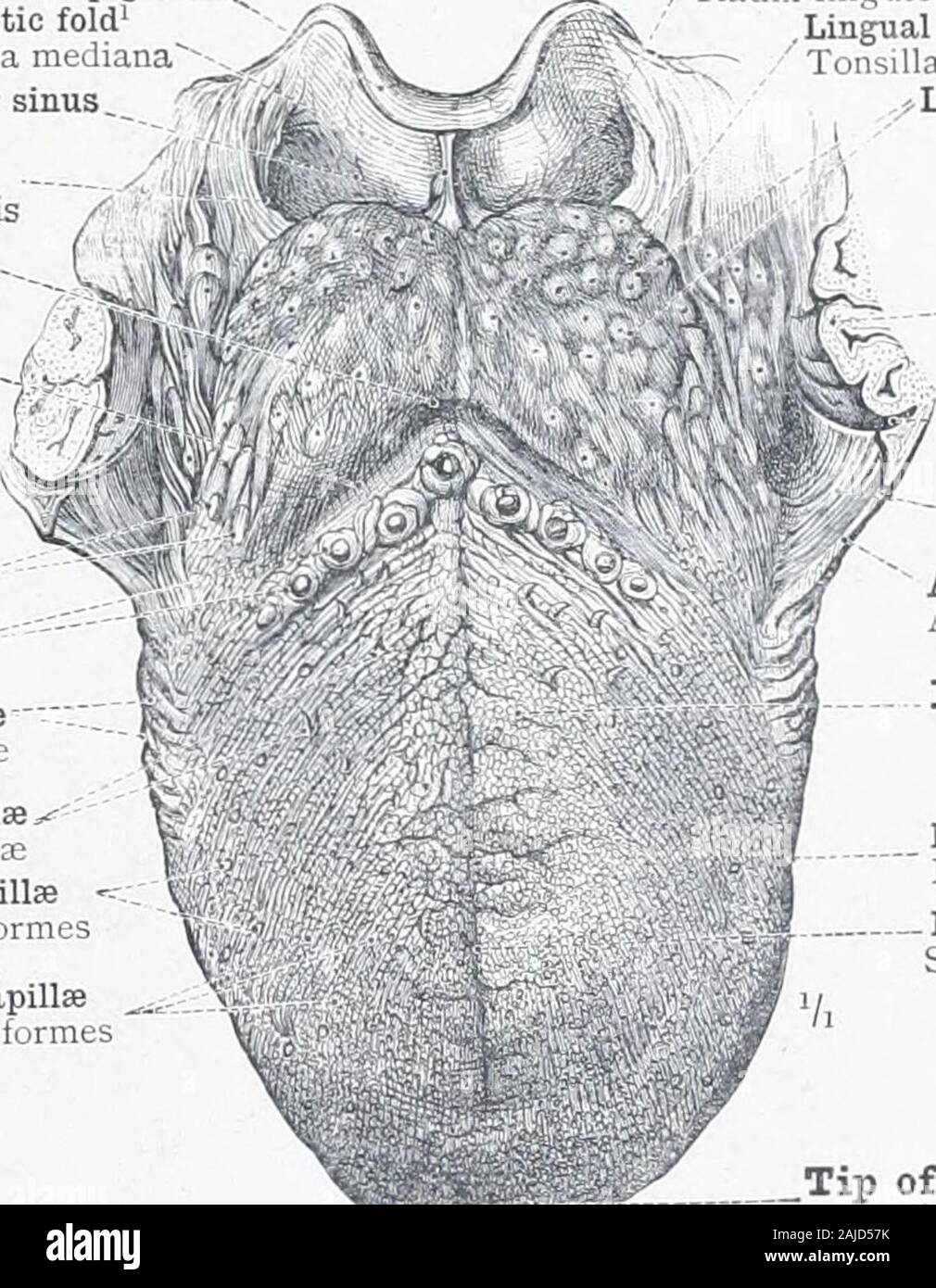 Ein Atlas der menschlichen Anatomie für Studenten und Ärzte. x untere Oberfläche der Zunge Facies inferior linguae Sublingual falten Plica sublingualis?-- Submaxillary Papille (canmculasublingualis), mit der öffnung des Kanals oder submaxillary ductof Wharton-Gum Gingiva Abb. 672.- den Mund weit geöffnet, mit der Spitze der Zunge oben gezogen und theFr/enum Lingu/E, der sublingualen Fach, die Papille (Submaxillary Caruncula Sublingualis), unddem Fimbriated Falten zu zeigen. EpiglottisMedian glosso - Falten epiglottio Ihca glossoepiglottica mediana^, Glosso - epiglottic Fossa oder Sinus/JVallecula epiglotticaLater Stockfoto