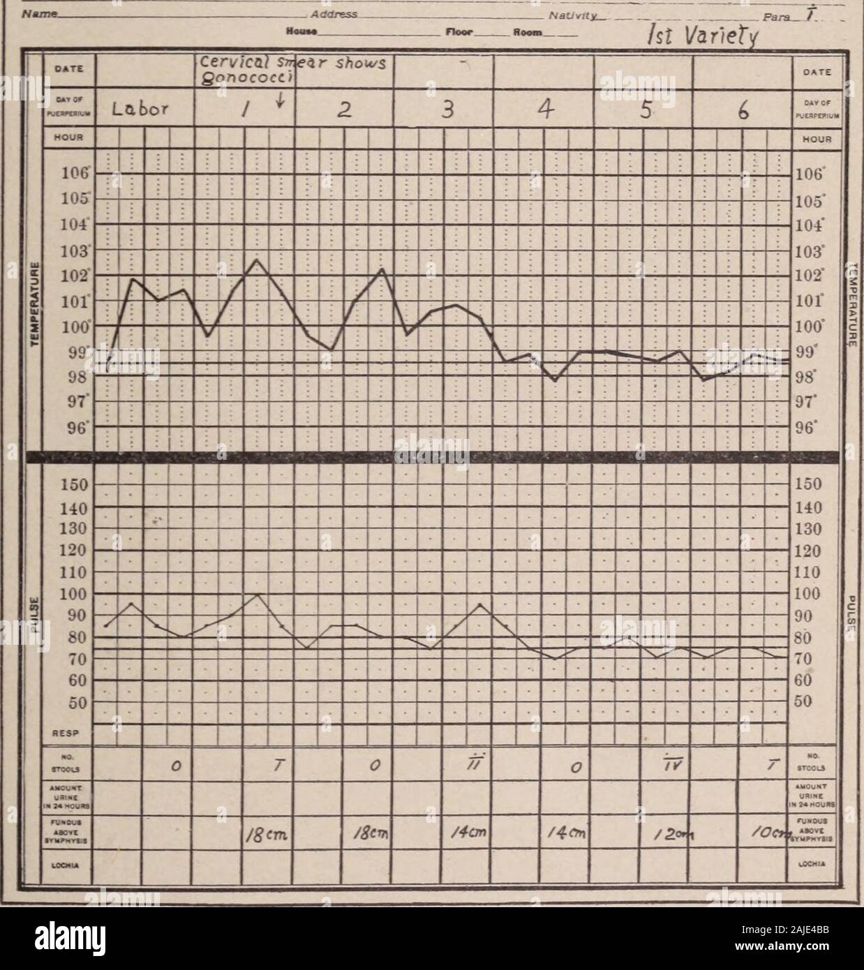 Transaktionen, die von der Amerikanischen Vereinigung der Geburtshelfer und Gynäkologen für das Jahr ... Mon Problem ist in unserer collab, weiterhin mit der bakteriologe. Wir sind der Meinung, dass einer Verwendung eine große Hilfe bei der Verwaltung der puerperalen Infektion durch die HOS-Pital Labor in die Details der Kultur und Verbreitung Folie Berichte gegeben. Es ist wahr, dass die Isolation des betreffenden Bakterium ist oft oflittle scheinbare Wert. Streptokokken in der Gebärmutter Fälle erhalten Welland sterile Kultur Fällen sterben. Die Forscher argumentieren, dass wir nicht mehr in baumwollklassierung ein Fall wie streptococcic toxemia gerecht sein - ein paar Ursache gerechtfertigt Stockfoto