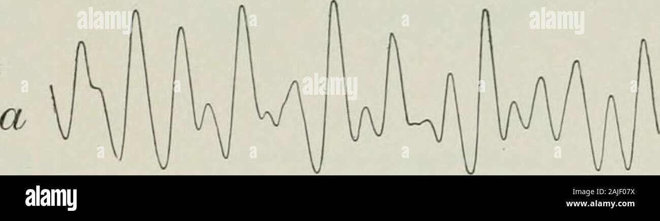 American Journal der Physiologie. ogic, 1891, v, S. 131. 2 Engelmann: Archiv fiir die gesammte Physiologische, 1869, II, S. 243-292. 3 Mosso und Pellacani: Archive italienncsde Biologische, 1882. i, S. 97-128.* Ashdown: Journal der Anatomie und Physiologie, 1887, Xxi, S. 299-324. 5 Sherrington: Journal der Physiologie, 1892, XIII, S. 628-772. ^ Langley und Anderson: Journal der Physiologie, 1894, XVI, S. 410-440. ^ Griffiths: Journal der Anatomie und Physiologie, 1894-95, xxix, S. 254-275. 8 Engelmann: Archiv fiir die gesammte Physiologische, 1869, II, S. 243-292. 9 Sertoli: Archive italiennes de biolo Stockfoto