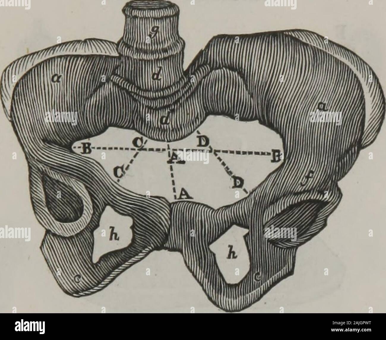 Zusammenfassung der Vorträge über Geburtshilfe und die Formen der Krankheit die speziell für Frauen und Kinder: für Studierende der Hochschule von Ohio Physio-Medical geliefert. A B, kurz oder sacro-pubic Durchmesser. D C, lange oriliac Durchmesser, a a, Darmbein Fossae, b, c, untere Wirbel. d, den oberen Teil des Os sacrum, c, Abschlußball, Kreuzbein, e e, sa-Cro-darmbein Symphyse, f f, Teile über die acetabula. g, symphyse Schamberg. Erläuterung der Platten. 429 PLATTE III. Ein schlecht geformte Becken.. ein, Ossa innominata. c, ossa Ischia. d, letzte Wirbel, schräg in das Kreuzbein. f, os Ilia h k, steingrab ovalia. Hier der Durchmesser B B, ist fast die Stockfoto