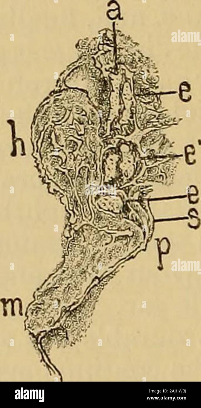 Ein text-Buch der Krankheiten des Ohres für Studierende und Praktiker. Energiebezogener akute exuda- tion in der externen Dachgeschoss, die ander ist das Ganze eine seltene Form der Krankheit, kann beproduced durch die gleichen Ursachen wie otitismedia Acuta. Der Autor hat Es repeatedlyobserved während eines Angriffs der Influenza (Kosegarten). Es entwickelt die meisten Fre- ten jedoch während der akuten naso-Pharyngealen catarrhs und in der acuteexanthemata. Knapp, die das Auftreten der aftersea - Bäder sah, dass die Infektion kann alsotake Ort aus der externen auditorycanal; diese Ansicht wird auch corroboratedby Walb. Laut dem ehemaligen, thebacteria Stockfoto