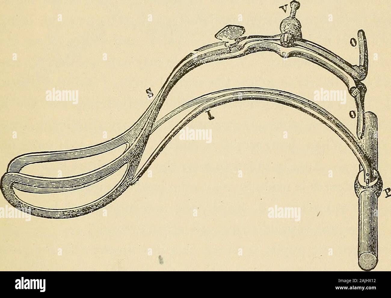 Cyclopaedia von Gynäkologie und Geburtshilfe. Kranke alterfrom k an k und den Kopf, wie es herab, wird auch in der Achse von thel) elvis, und drücken Sie nicht gegen die anteriore Beckenwand. Morales hat auch zwei Pinzetten, die, obwohl progressive mod-ifications, um ernsthafte Einwände offen sind. Schließlich Tarnier, ab 187? Bis 1879, über 30 Pinzetten erfunden, der FOECEPS. iO, die wir hier beschreiben, wird nur das erste und das letzte Modell. (Abbn. 75 und 76.) Im Folgenden sind die Besonderheiten der ersten Modell, dass von 1877. Es besteht aus zwei Griffen, und von zwei Traktion Stangen. (Abb. 75 Stockfoto