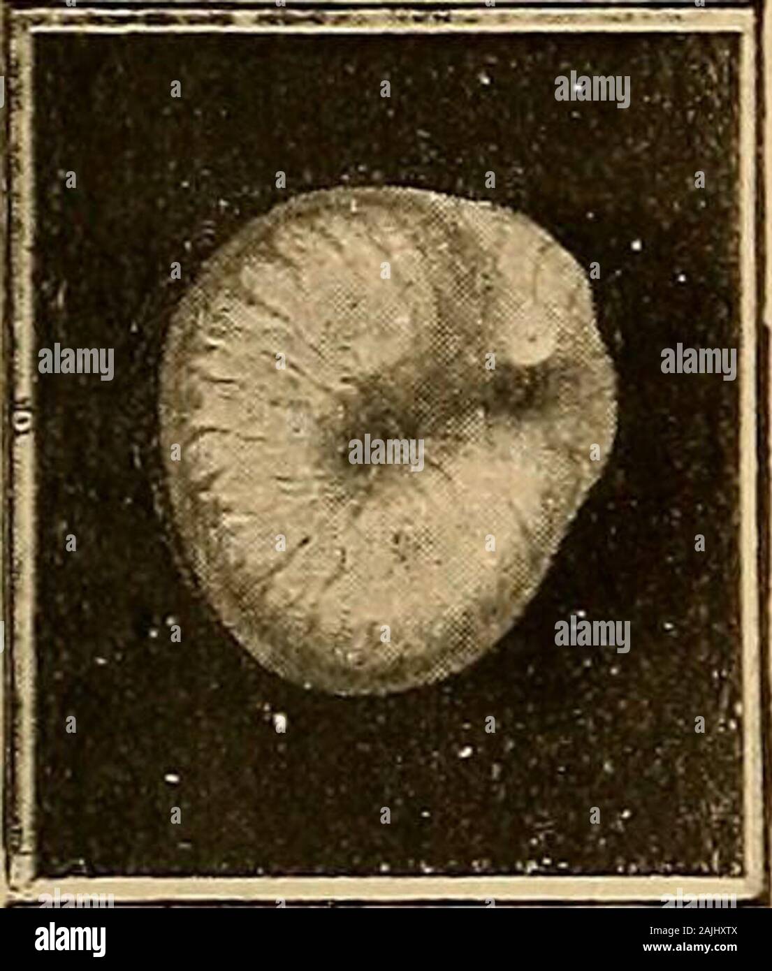 Otitis externa Fotos und Bildmaterial in hoher Auflösung Alamy