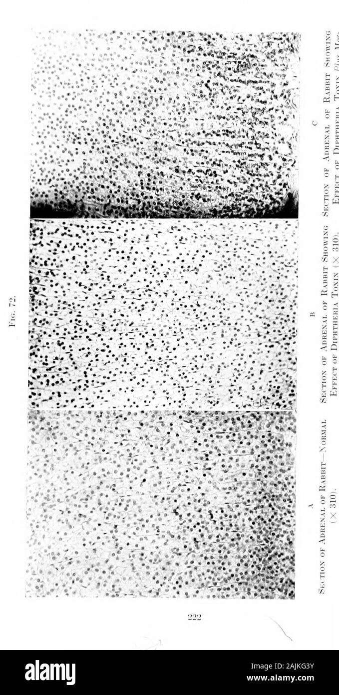 Den Ursprung und die Natur der Emotionen; verschiedene Papiere. ation, durch Überlastung, oder durch emotionale Erregung. Wir sehen nun, dass die reasonwhy wir so viel Schwierigkeit in der ZAHLREI-akute Infektionen von einander unterscheiden zu finden ist, weil Sie die gleiche kinetische Kette playupon. Unser Postulat harmonizesthe pathologischer Demokratie der kinetischen Organe, für die es ex-Ebenen nicht nur in vielen Krankheiten, die pathologicchanges in diesen Organen sind identisch, aber warum die samechanges sind als Ergebnis der emotionale Belastung und über gesehen. So können wir verstehen, wie entweder emotionale strainor akute oder c Stockfoto