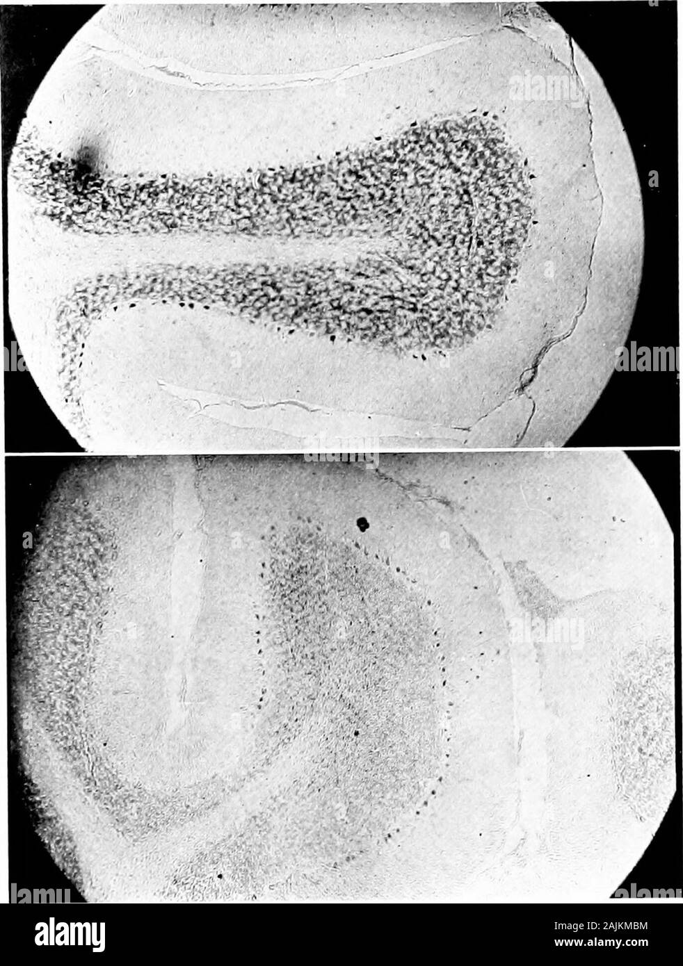 Den Ursprung und die Natur der Emotionen; verschiedene Papiere. rves Leben, wenn es von acuteinfections bedroht. Der Beitrag des Gehirns - Zellen zur Produktion von Wärme wird entweder das Ergebnis der direkten conversionof Ihre gespeicherte Energie in Wärme oder der Umwandlung Ihres latente Energie in Strom oder eine ähnliche Kraft, whichin wiederum bestimmte Drüsen und nuiscles latentenergy in Wärme umwandelt. Eine weitere Unterstützung für das Postulat, dass das Gehirn - cellscontribute auf die Produktion von Fieber durch Senden Impulse Muskeln andie ist in der Wirkung der muskulären Anstrengung, oder ofothe gefunden Stockfoto