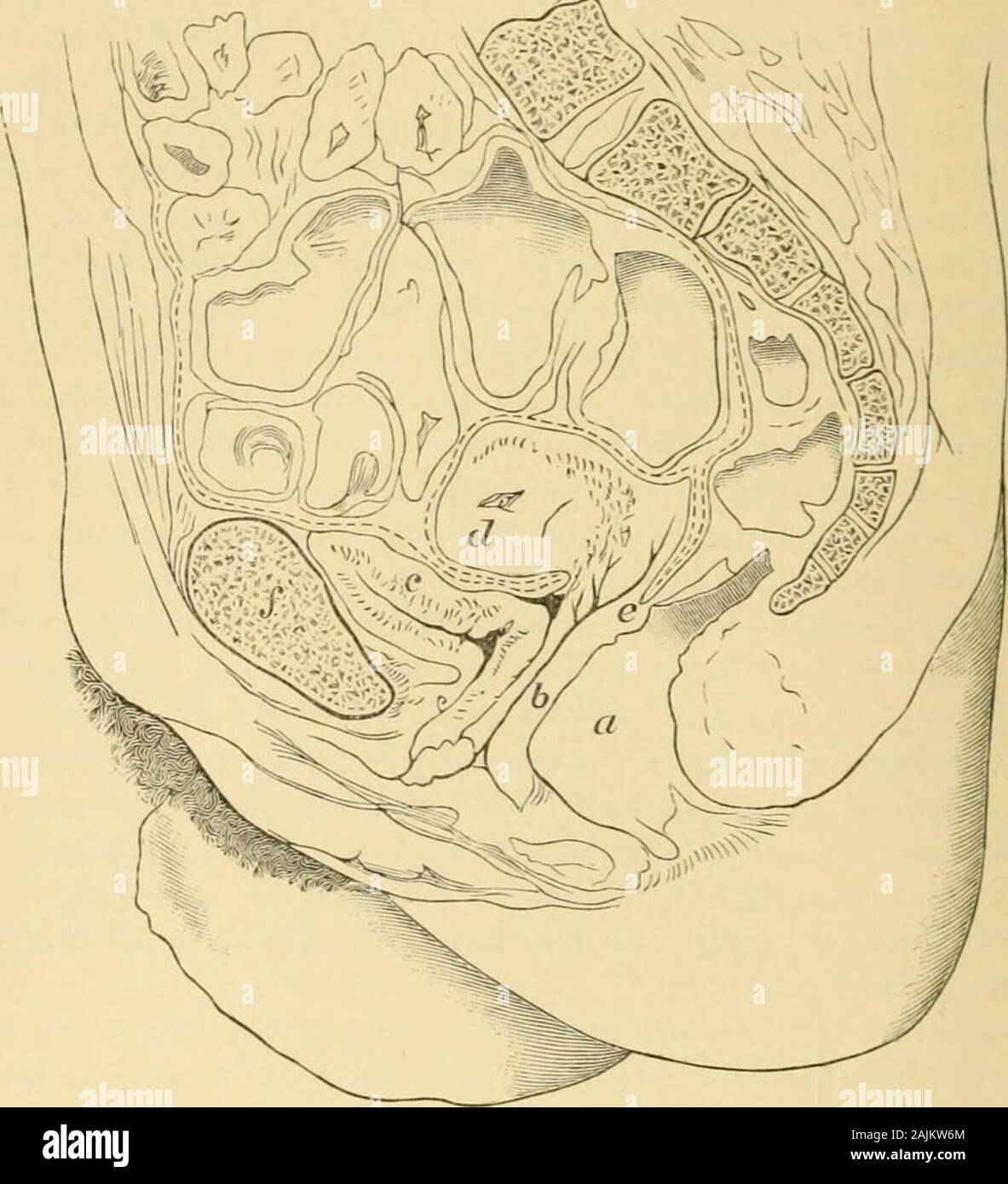 Ein System der Gynäkologie. Zu den verschiedenen Neoplasmen und ihre Herkunft können wir nur finden; dass siemaximal werden aus vorhandenen Elementen gebildet - offensichtlich wird der normale Histologie, thestudent. Die HARNWEGE. Der Teil der Fläche, die in der Regel mit dem genitalOrgans beschrieben, umfasst die Harnröhre, die Blase und die Beendigung des theureters. Diese werden in der gleichen Reihenfolge wie thegenital waren Organe, also von unten nach oben betrachtet werden. Harnröhre. Syxoxyms. -&gt; //-., oupijdpa; Lat., canal Urinarius ist, der Harnröhre, der ITER-uri-narium;/•&gt;., urethrc, uretre; Ger., Harnrohre; Sp. und It., Burla Stockfoto
