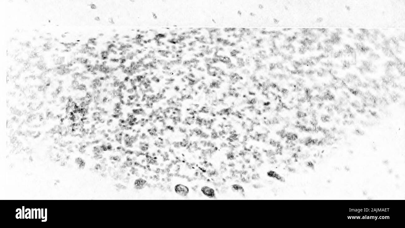 Den Ursprung und die Natur der Emotionen; verschiedene Papiere. y. CO O X .2^^. S X Der liiain dischaiged er durch Injur) - undei-Anästhesie oi-liyOJdinai-y-muskulöse excj-tion, identische moiphologic Chang (^ sai-e im nc-gesehen) e-Zellen. Im Schock der Verletzung (Abb. 2), in Erschöpfung lioiu o-ei-vork (Hodge und Dolkn) (Abb. 4), Stockfoto