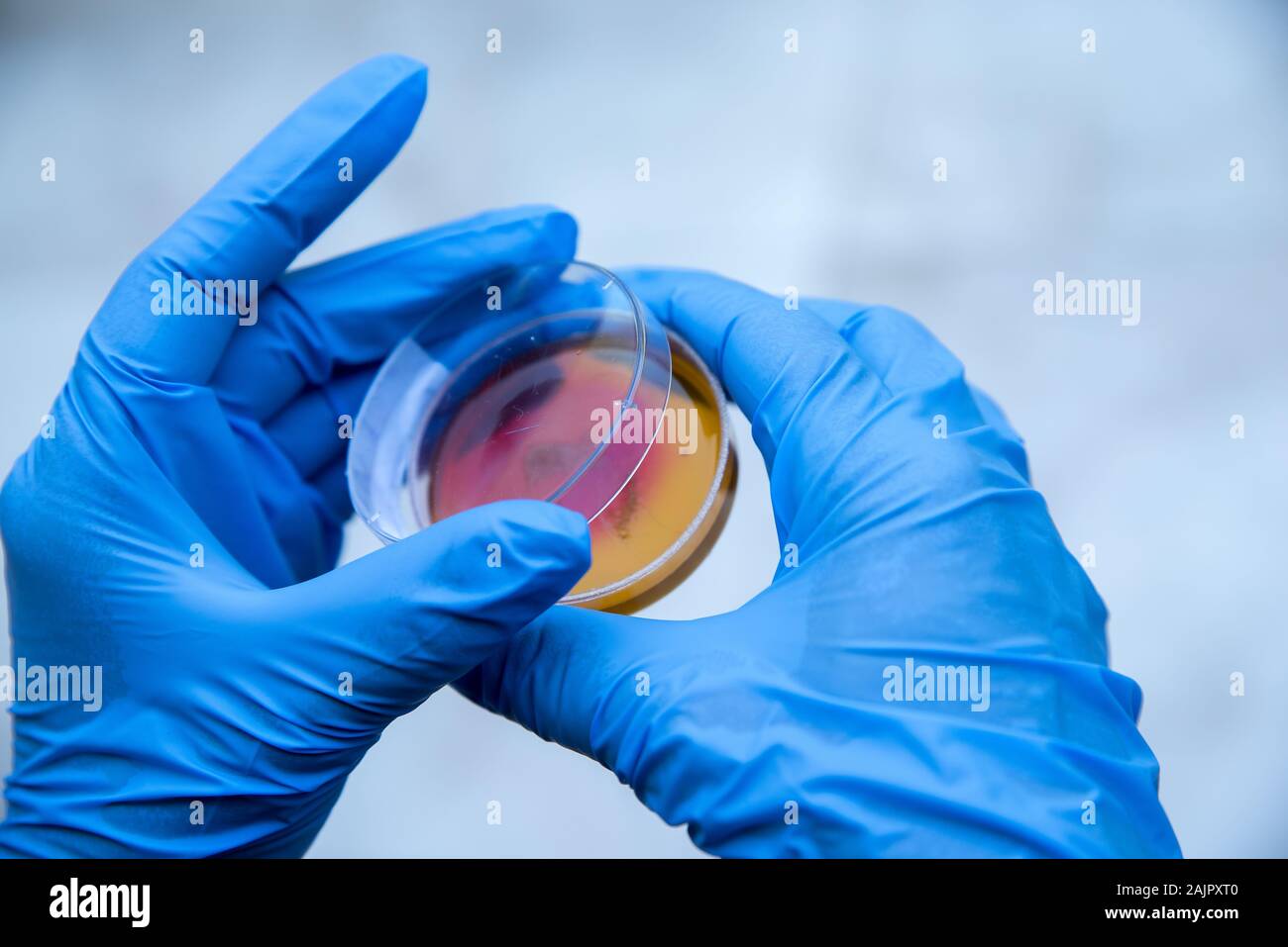 Mikrobenkulturen sind grundlegende und grundlegende Diagnose Stockfoto