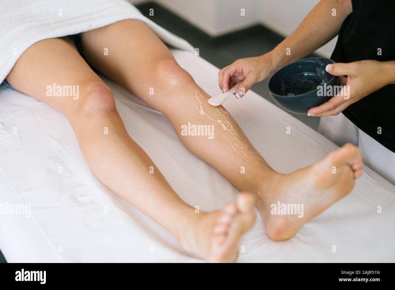 Laser Haarentfernung. Laser kosmetische Behandlung unerwünschte Haare zu entfernen Stockfoto