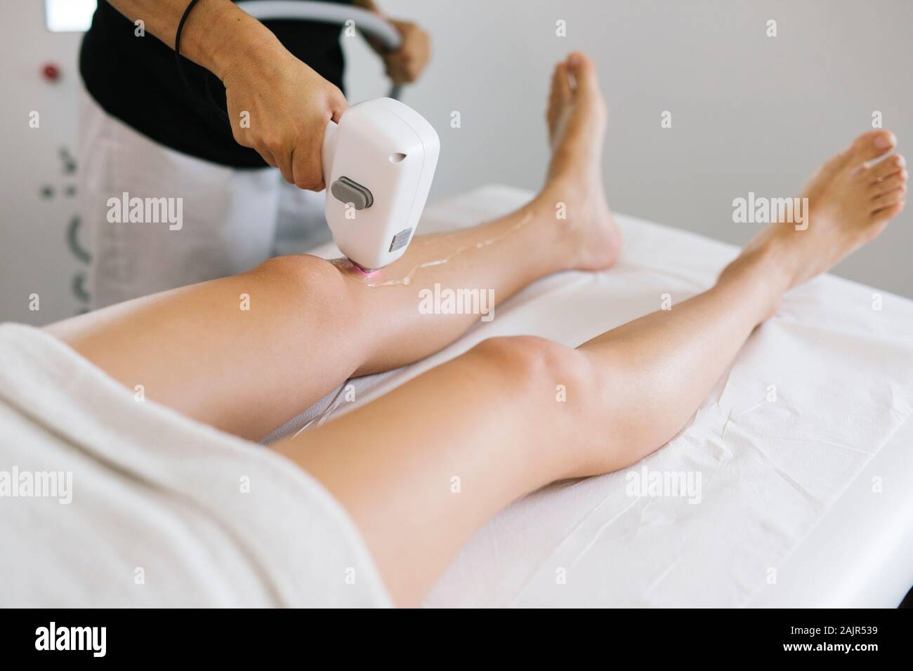 Laser Haarentfernung. Laser kosmetische Behandlung unerwünschte Haare zu entfernen Stockfoto