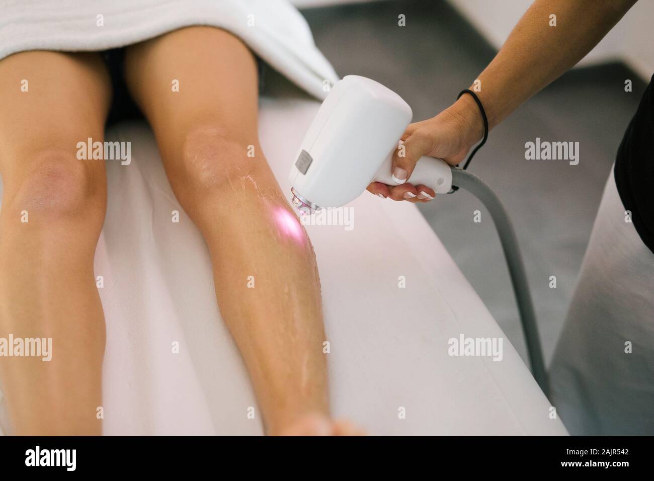 Laser Haarentfernung. Laser kosmetische Behandlung unerwünschte Haare zu entfernen Stockfoto