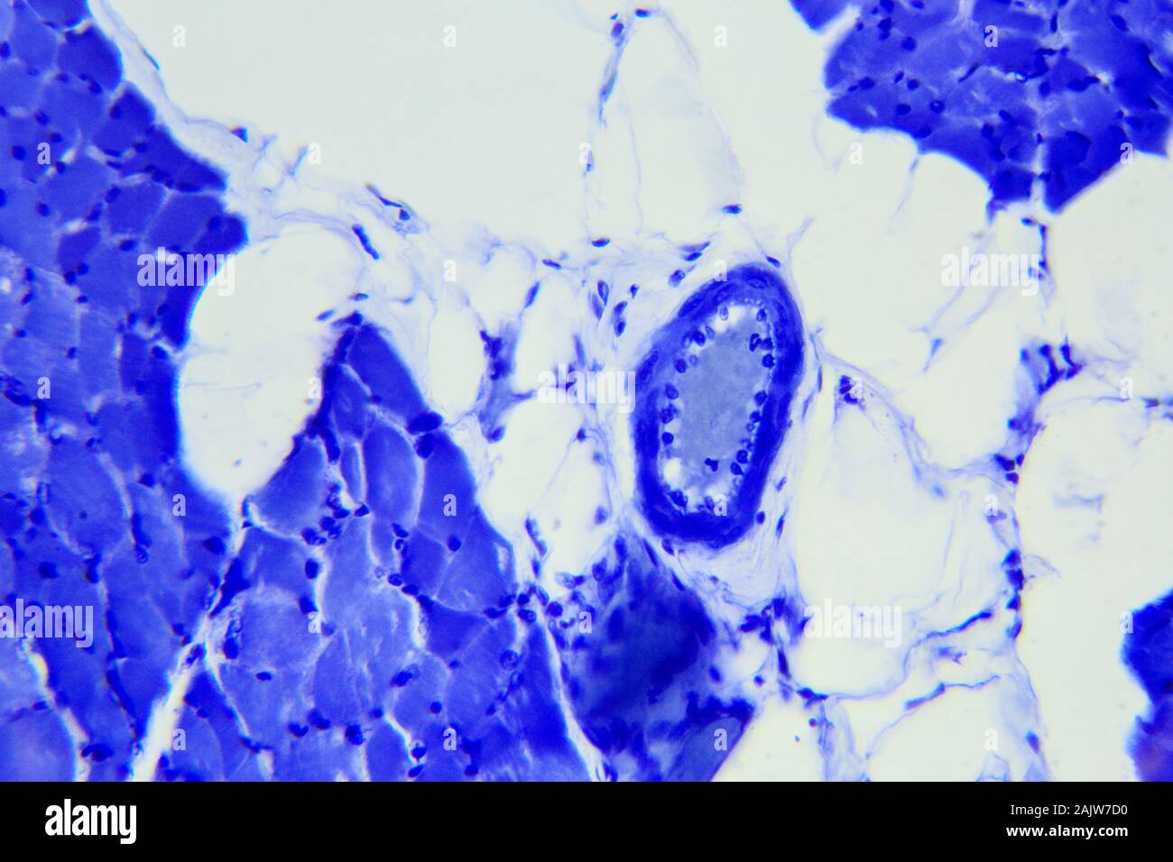 Skelettmuskulatur Gewebe Längsschnitt unter einem Mikroskop, der Skelettmuskulatur L.S. Stockfoto