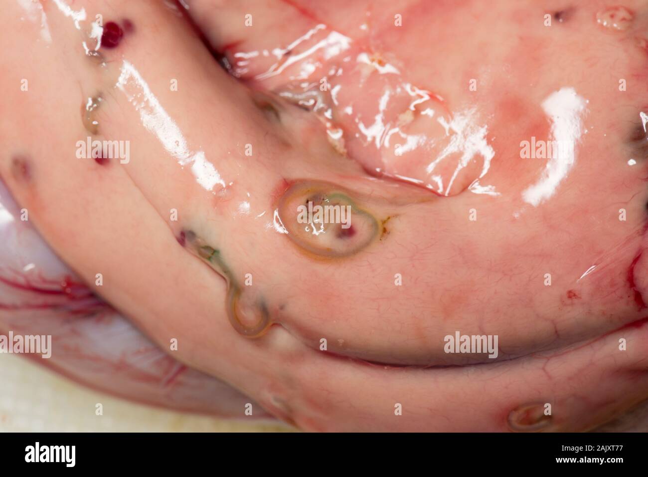 Parasitäre Nematoden anisakid Würmer in die Leber eines Kabeljau Gadus morhua, die auf der Stange und Line in Morecambe Bay vom Boot im Winter gefangen wurde. Wenn Inge Stockfoto