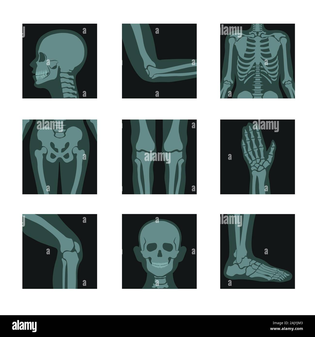 Skelett und Knochen Röntgenaufnahmen, Kopf und Hände, Beine und Gelenke Stock Vektor