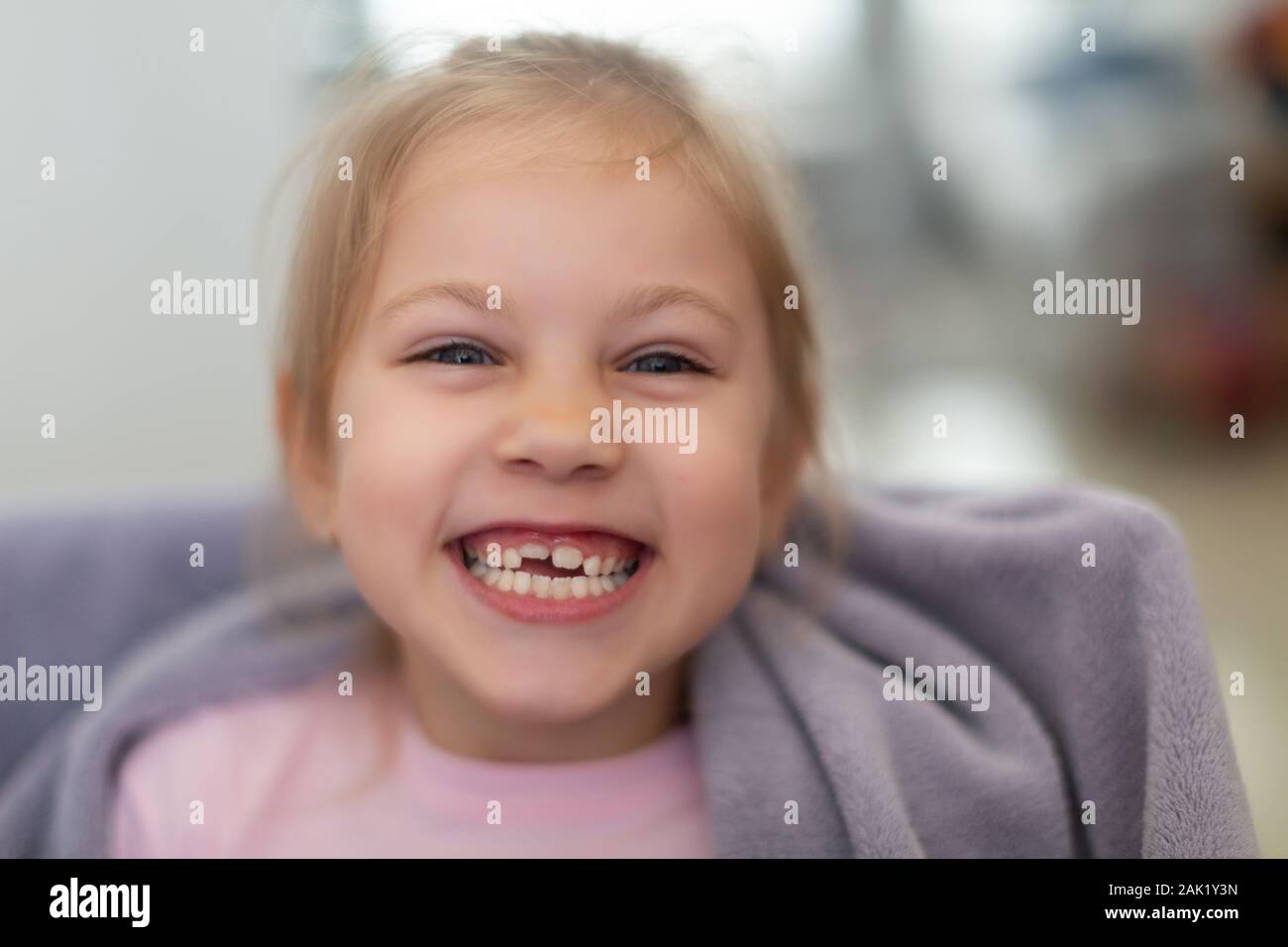 Freundlich lächelnde niedliche Kind mit den Zähnen heraus fallengelassen Vorschüler Mädchen mit offenen Mund ohne Milch Zahn Stockfoto