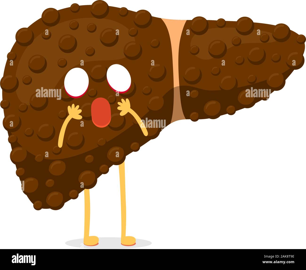 Krank ungesunde Cartoon Leber Charakter leidet an Zirrhose oder Hepatitis und Schmerzen leiden. Konzept zur Zerstörung von Organen der menschlichen exokrinen Drüse. Vektor hepatische degenerative Maskottchen Illustration Stock Vektor
