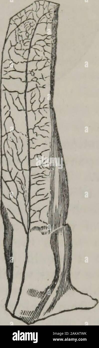 Elemente der pathologischen Anatomie. Wie sind die ersten Schritte der Entzündung. Wenn der Prozess jetzt Checkedby der Ausbau des spannenden verursachen, die Phänomene allmählich dis^ angezeigt, und das Teil wieder natürlichen Ton und den Zustand bezeichnet werden. Wenn auf der anderen Seite die Entzündung erlaubt werden muss, anotherseries Änderungen können beobachtet werden, die, wenn möglich, in Punkt von Interesse, die gerade beschrieben. Die Zirkulation nun nicht mehr vollständig; die bloodassumes Eine dunkle Farbe, Modena und die Wappen der Schiffe renderedso weich wie zu haften, auf die geringste Kraft zu geben. Stockfoto