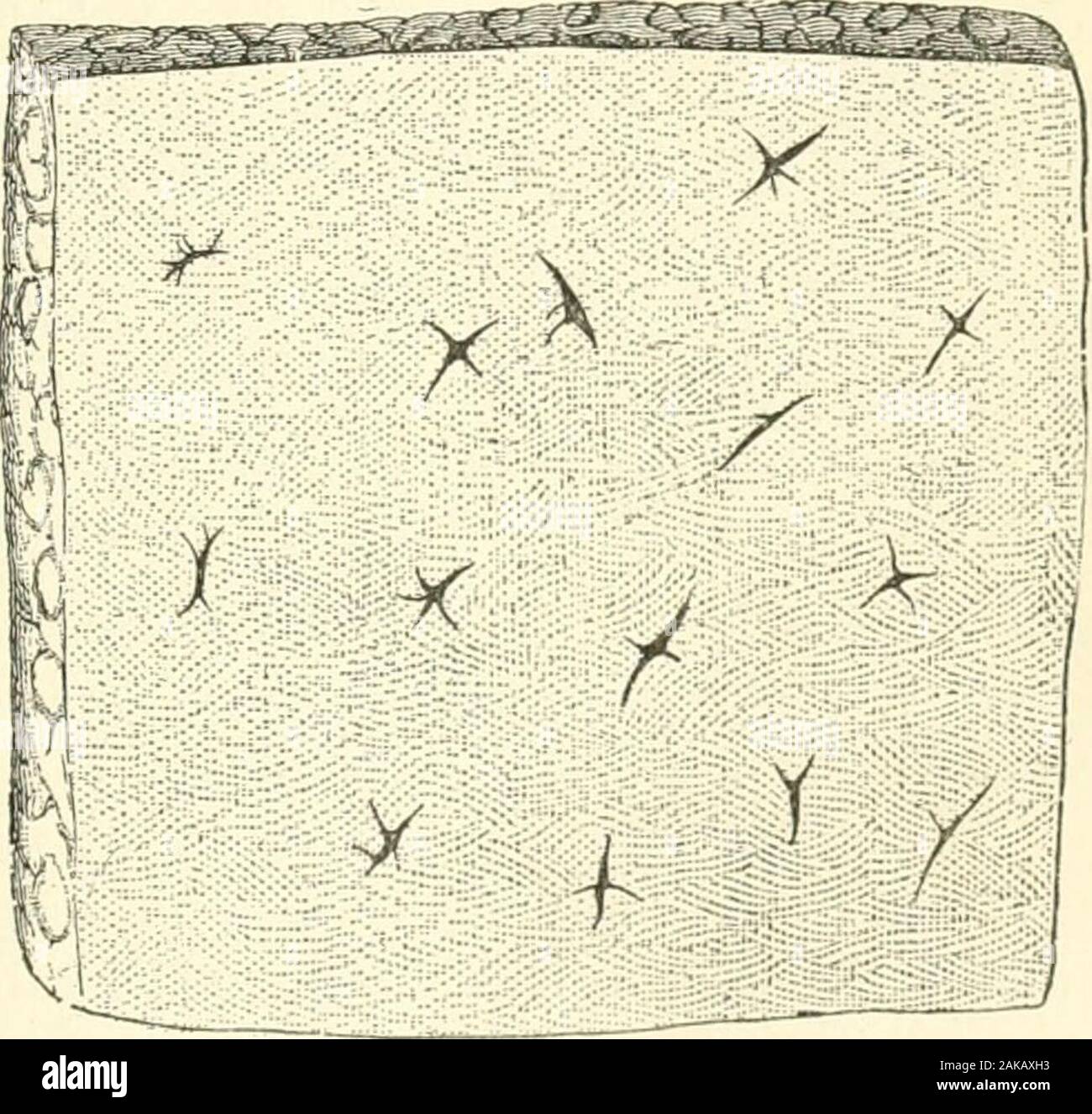 Ekchymose Fotos und Bildmaterial in hoher Auflösung Alamy