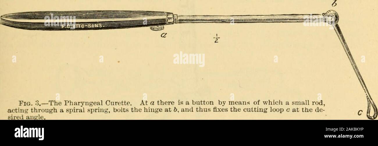 Ein Handbuch von Erkrankungen des Rachens und der Nase: einschließlich der Rachen, Kehlkopf, die Luftröhre, die Speiseröhre, der Nase und dem Rachen. Er Hand), die in jedem beliebigen Winkel der Welle fixiert werden kann, durch ein Kugelgelenk und verriegeln. Es ist sehr nützlich für die scrapingaway inspissated Sekretion in Fällen von follikulärem Krankheit, especiallywhen die Zuneigung entsteht am unteren Teil des Rachens oder attacksthe Kehldeckel. Es kann auch für zerreißen weg Adenoiden vegetationsfrom der Gewölbe des Pharynx eingesetzt werden. Die Ibnsillotome. - Instrumente für den Ausbau der vergrößerte Tonsille arenow sehr häufig eingesetzt werden, und der Mann Stockfoto