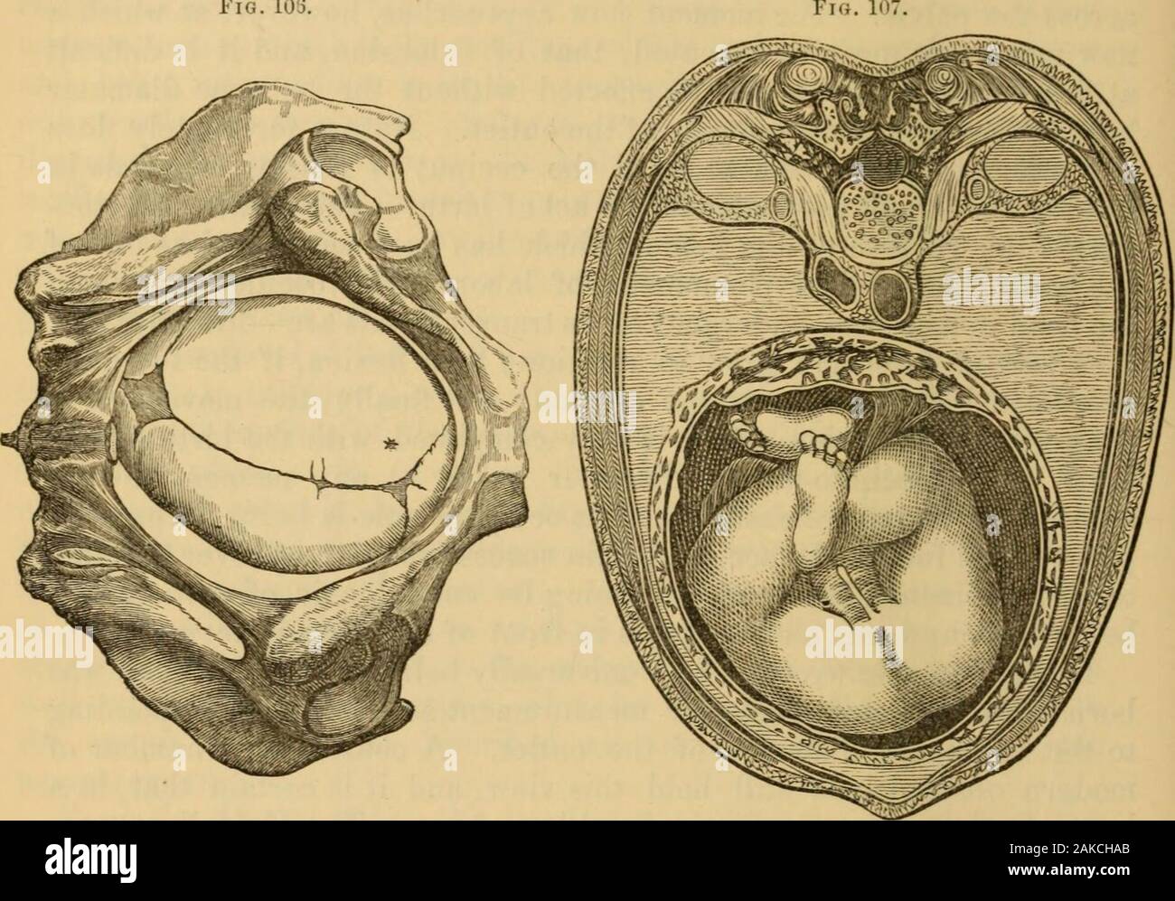 Ein System von Hebammen: Einschließlich der Erkrankungen während der Schwangerschaft und der Puerperalen Zustand. havehut zu getreu kopiert. Für diese obliquities comparativelytrifling sind von Bedeutung und sollte nie mit anderen und wirklich wichtigen Bewegungen geklammert worden sind. Bis er vollständig masteredthe Letztere, wir sollten ad € der Student keine Notiz von diesen obliqui-Riegel. Die mosi jüngsten Autoren zu den Themen (Kiineke, Hodge, und Duncan) alle Streitigkeiten die Schlussfolgerungen der Naegele und plädieren für die Parallelität, oder, wie sie es, Synclitism, der biparietal und Zerviko-bregmatic Flugzeug - von Stockfoto