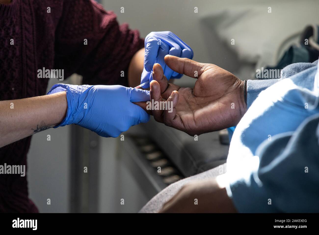 Homelessman eine Blutprobe auf 'Finden und Behandeln "NHS Van findet, obdachlose Menschen mit TB und Hepatitis C Vor-Ort-Diagnose, UK zu geben Stockfoto